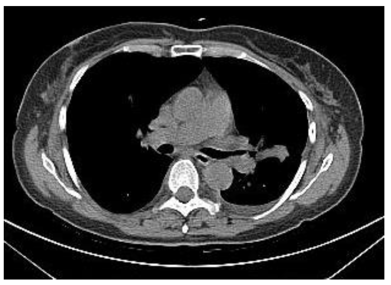 Tomography 10 00058 g005 Tomography 10 00058 g005