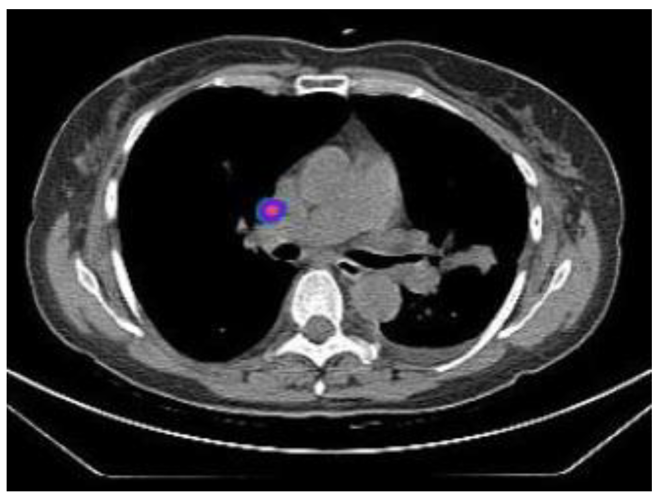 Tomography 10 00058 g006 Tomography 10 00058 g006