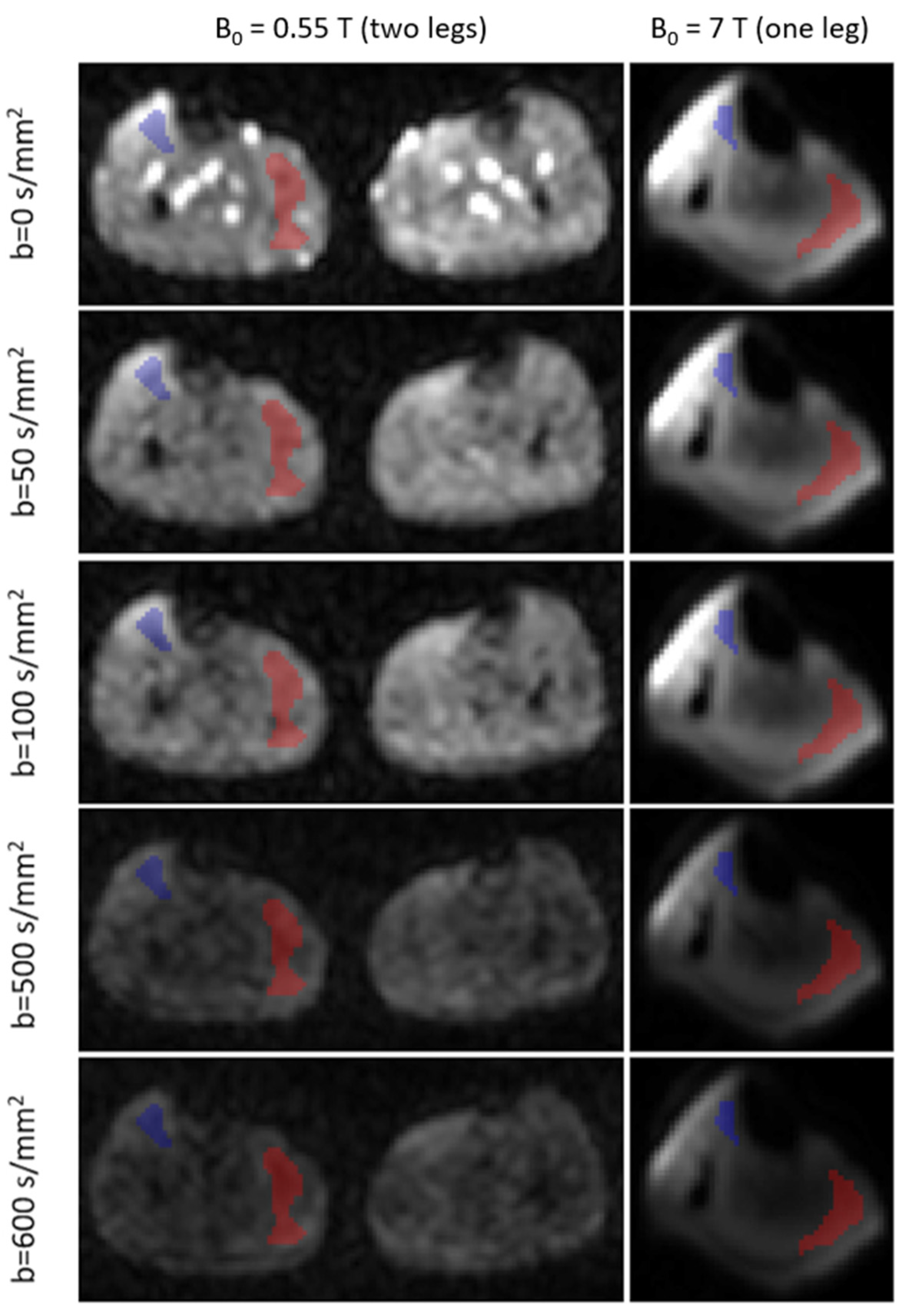 Tomography 10 00059 g003 Tomography 10 00059 g003