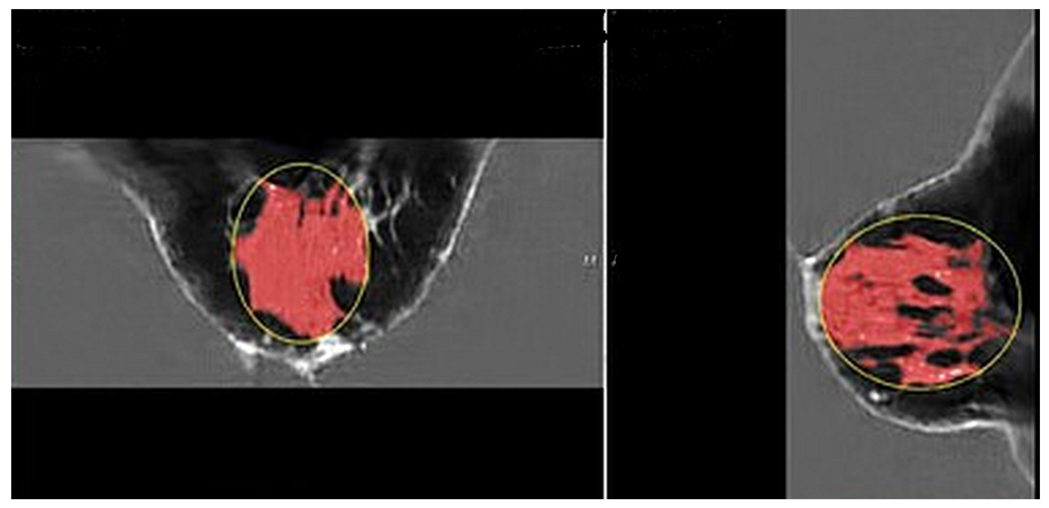 Tomography 10 00060 g002