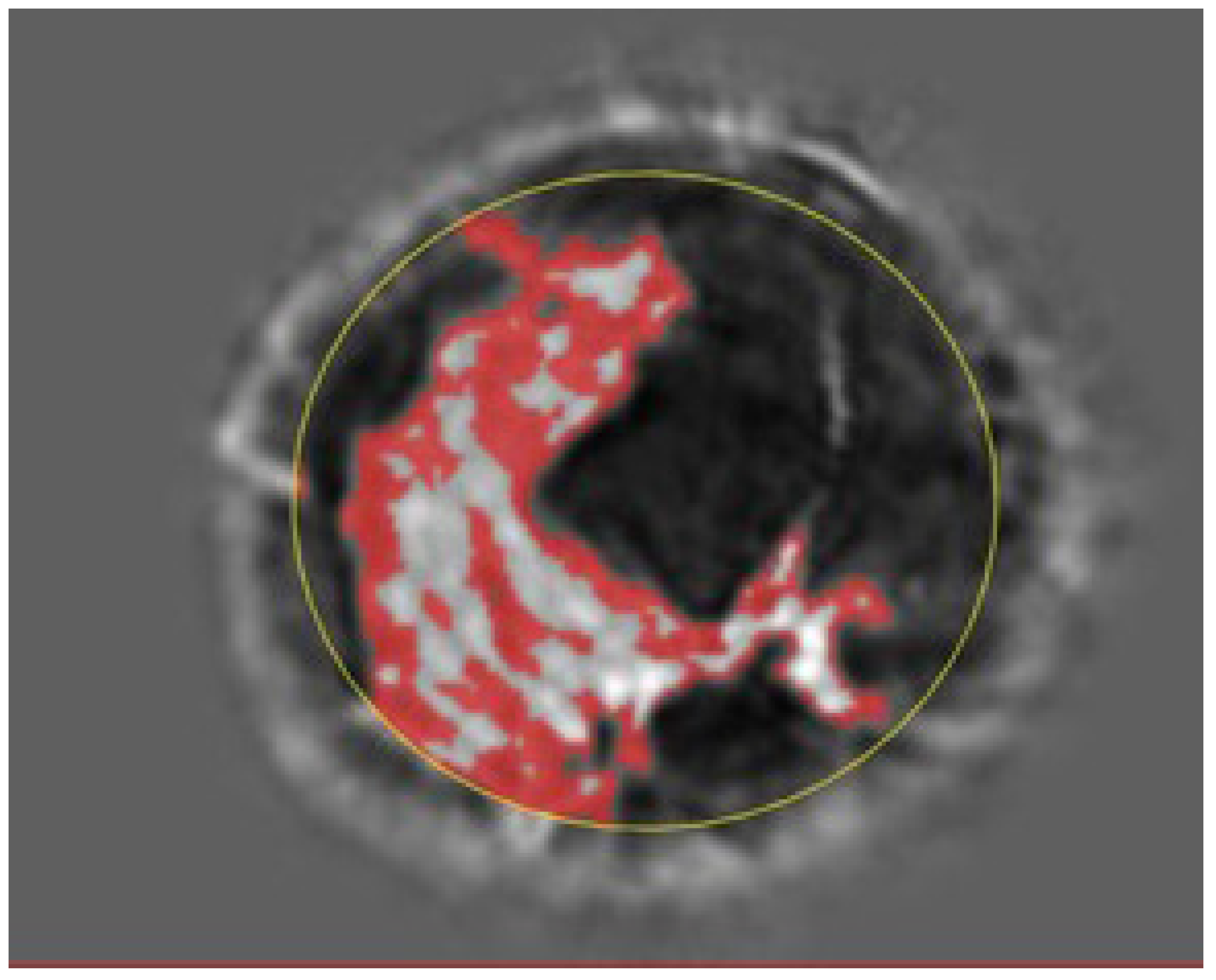 Tomography 10 00060 g003