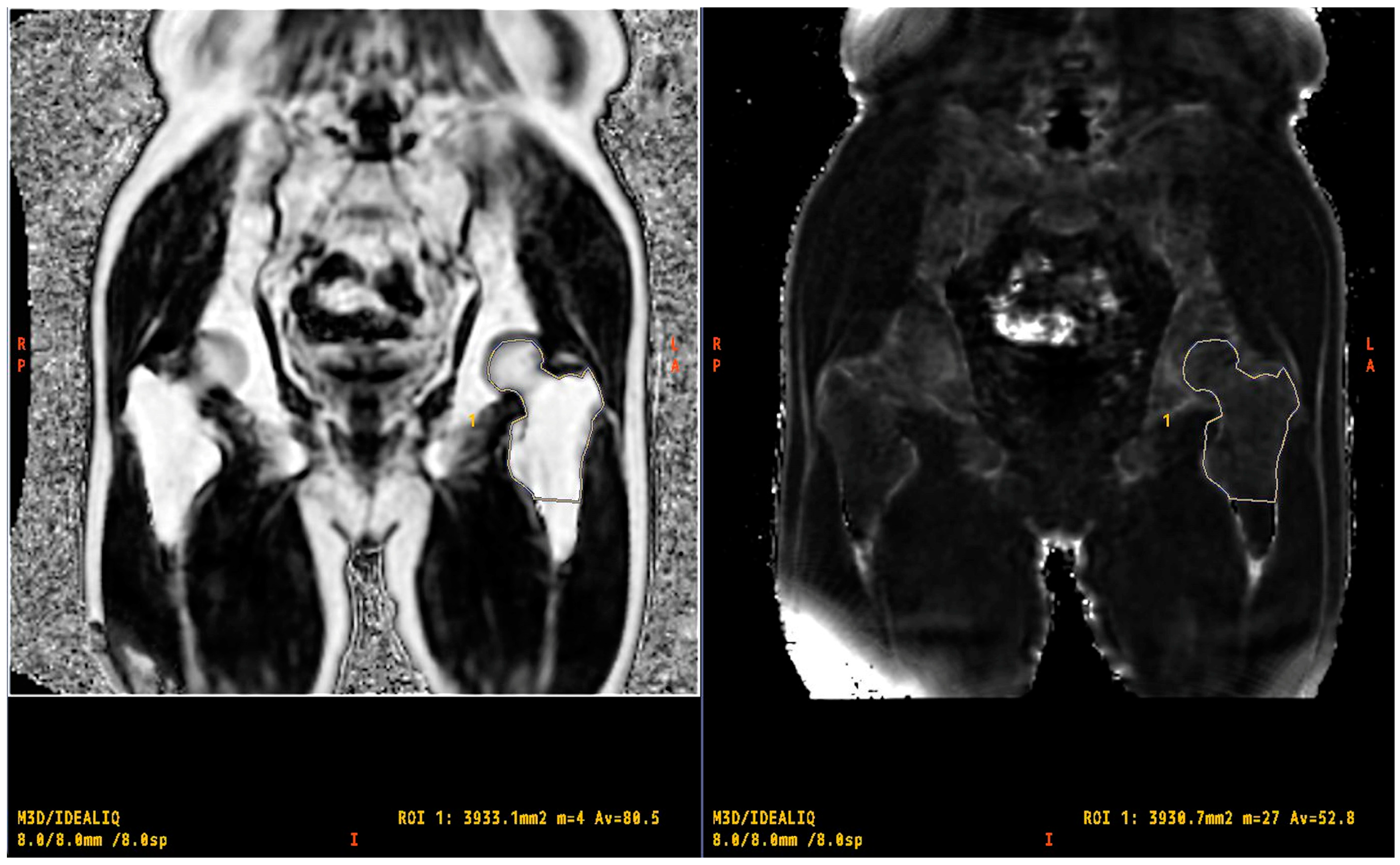 Tomography 10 00062 g001