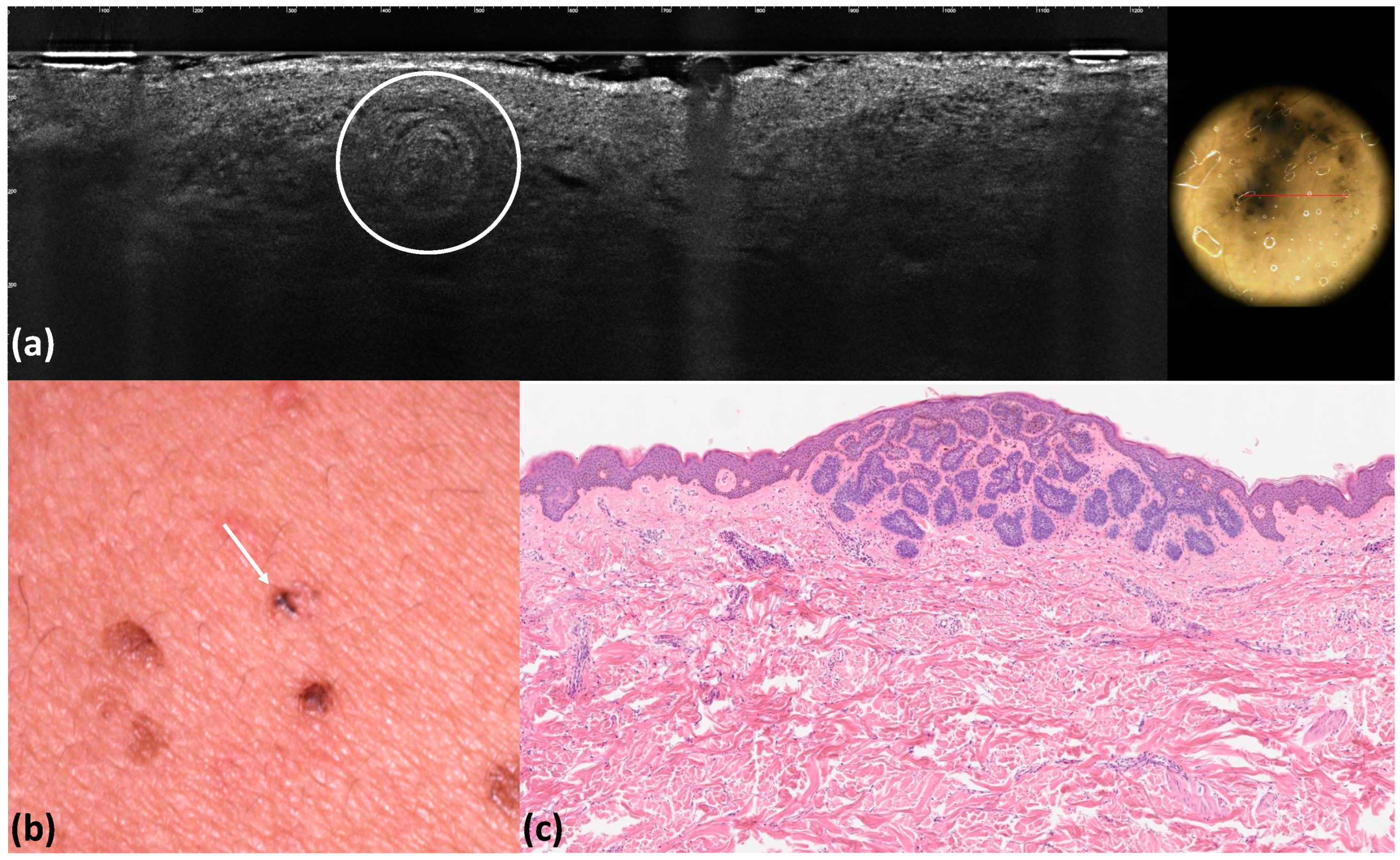Tomography 10 00063 g003