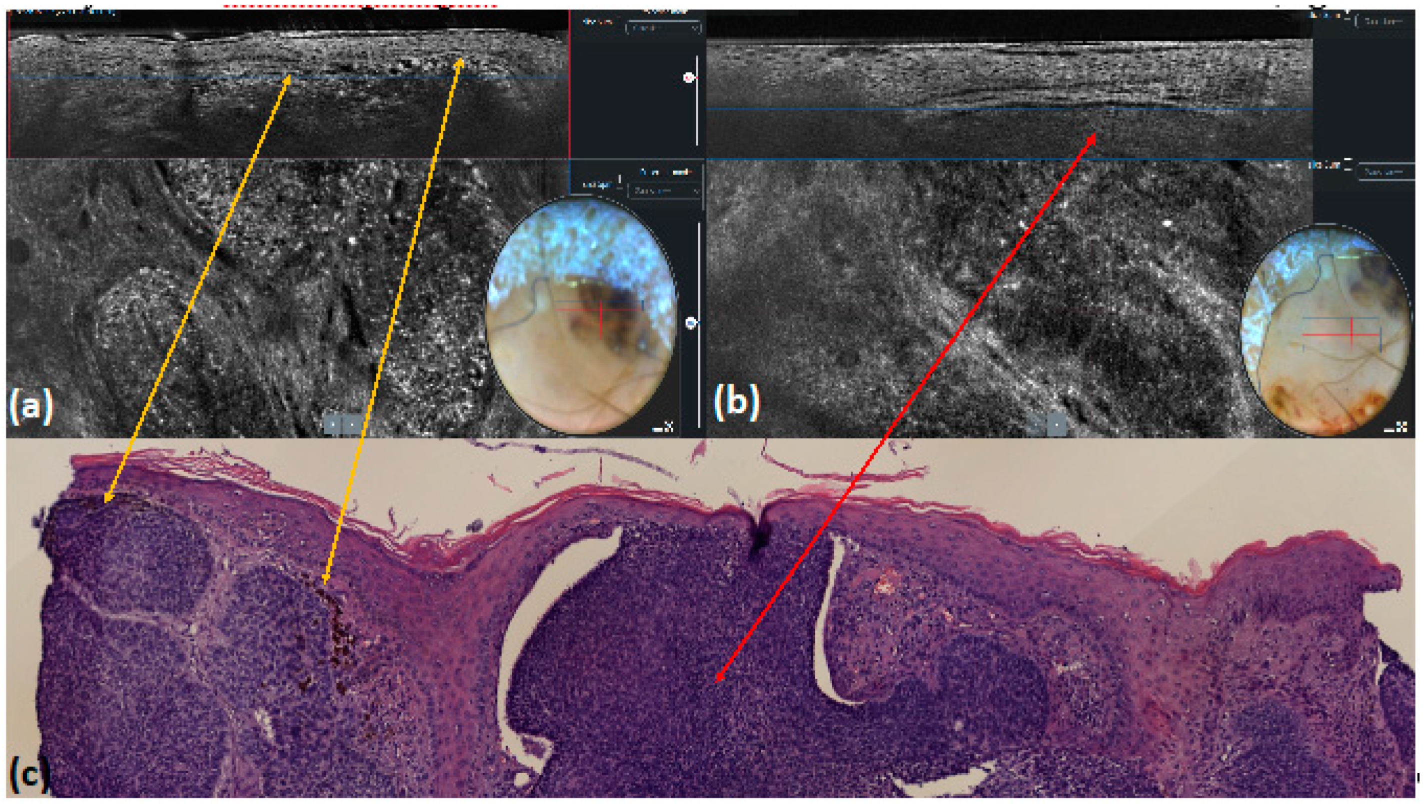 Tomography 10 00063 g004