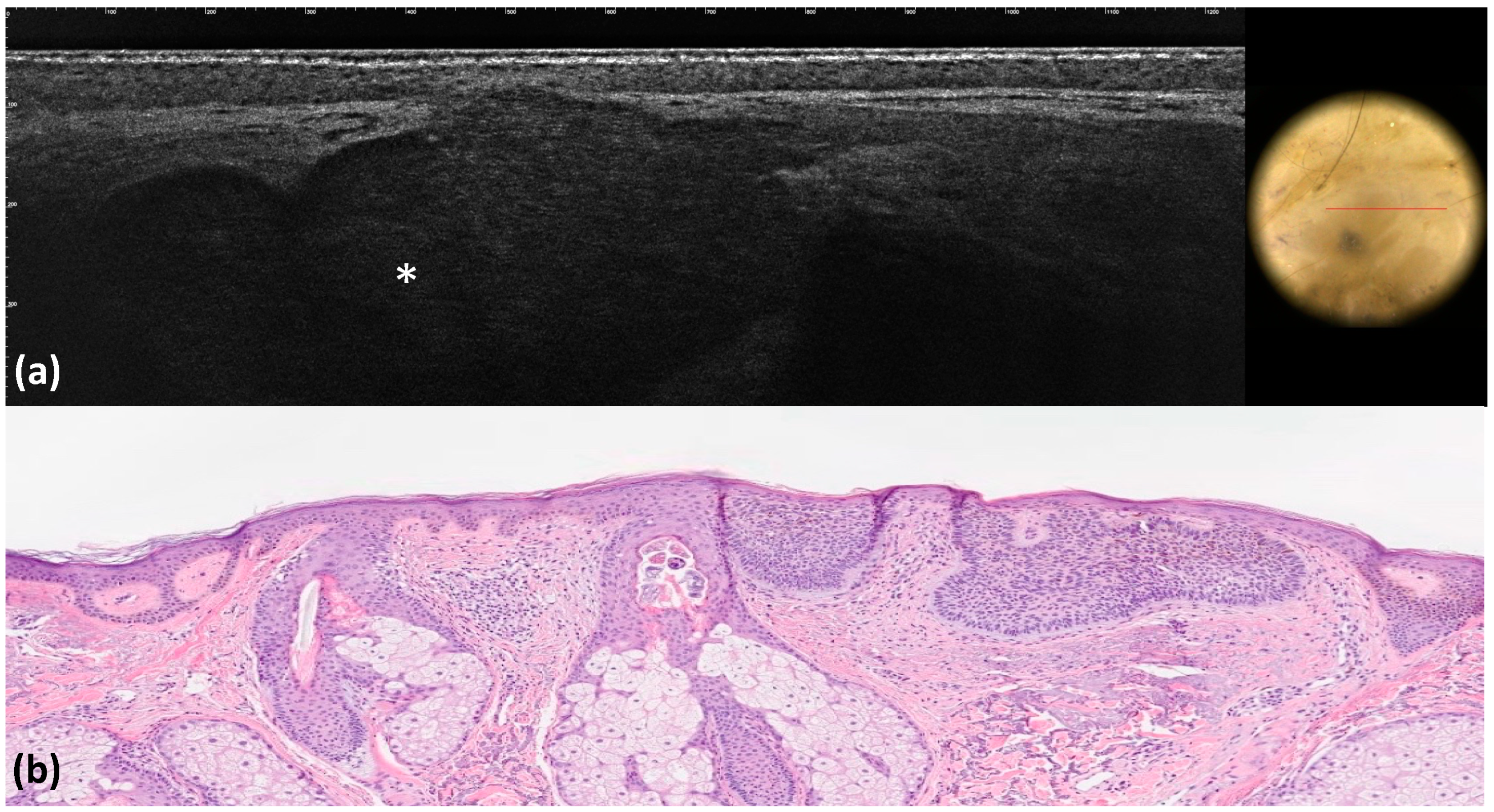 Tomography 10 00063 g005
