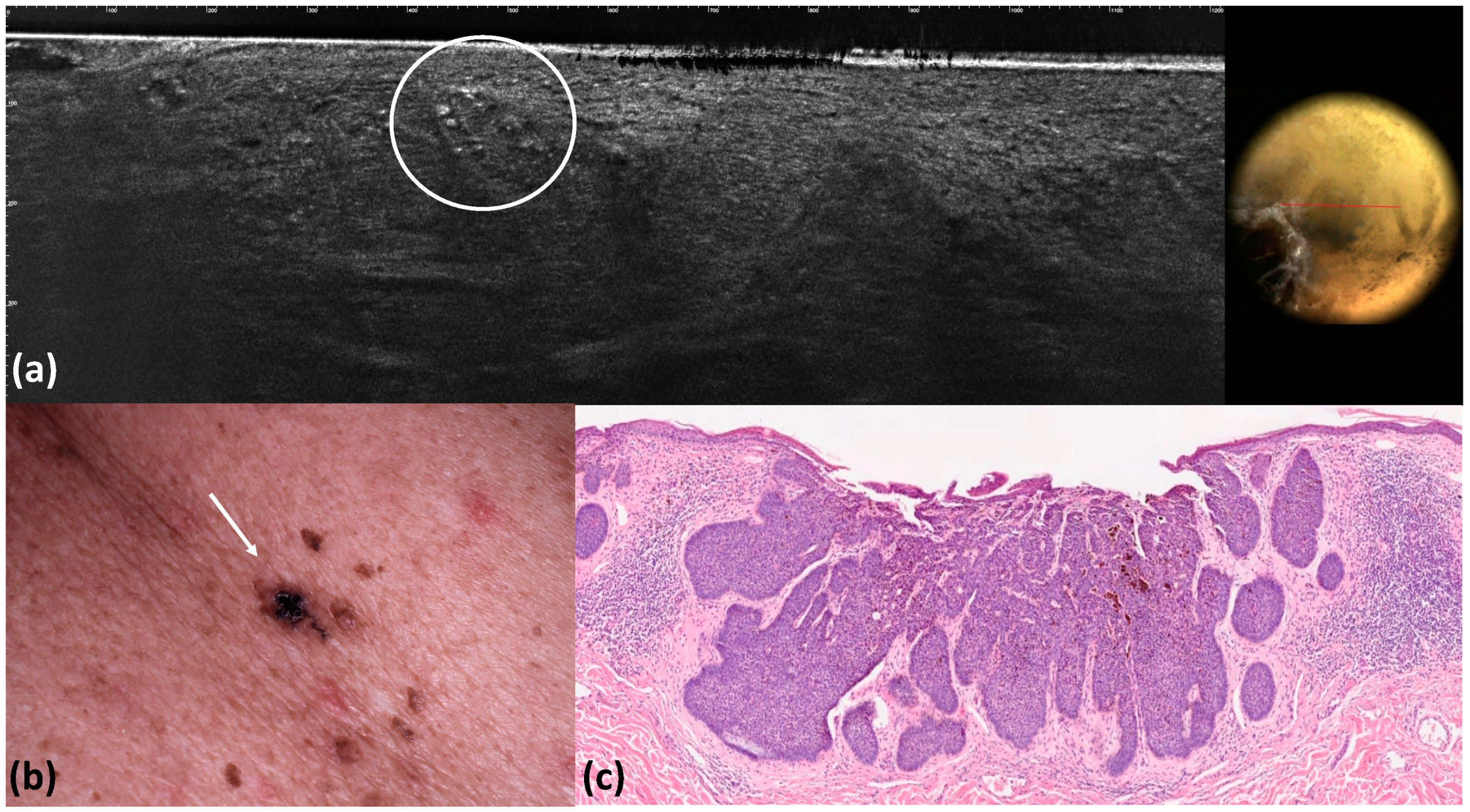 Tomography 10 00063 g007
