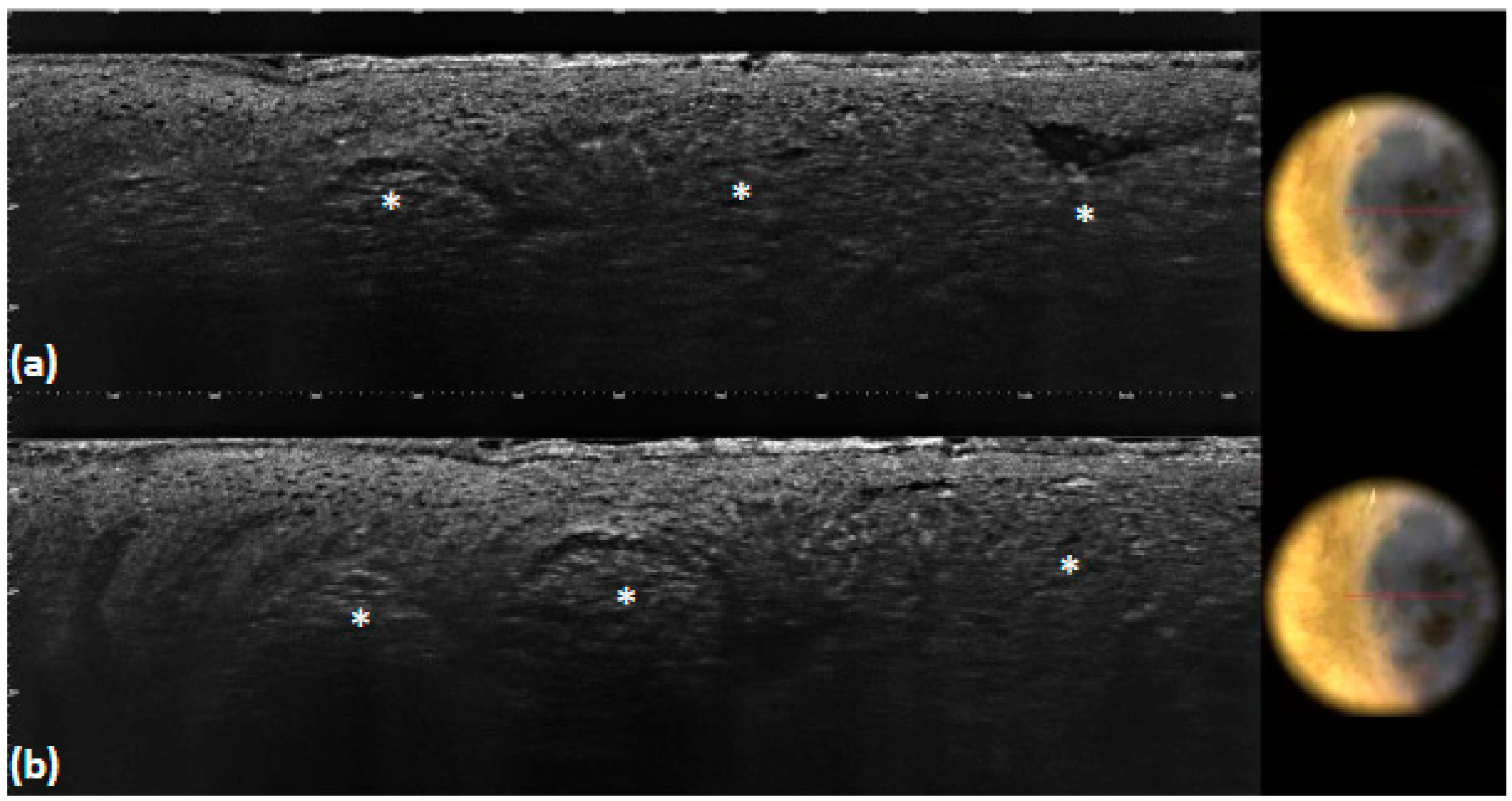 Tomography 10 00063 g009