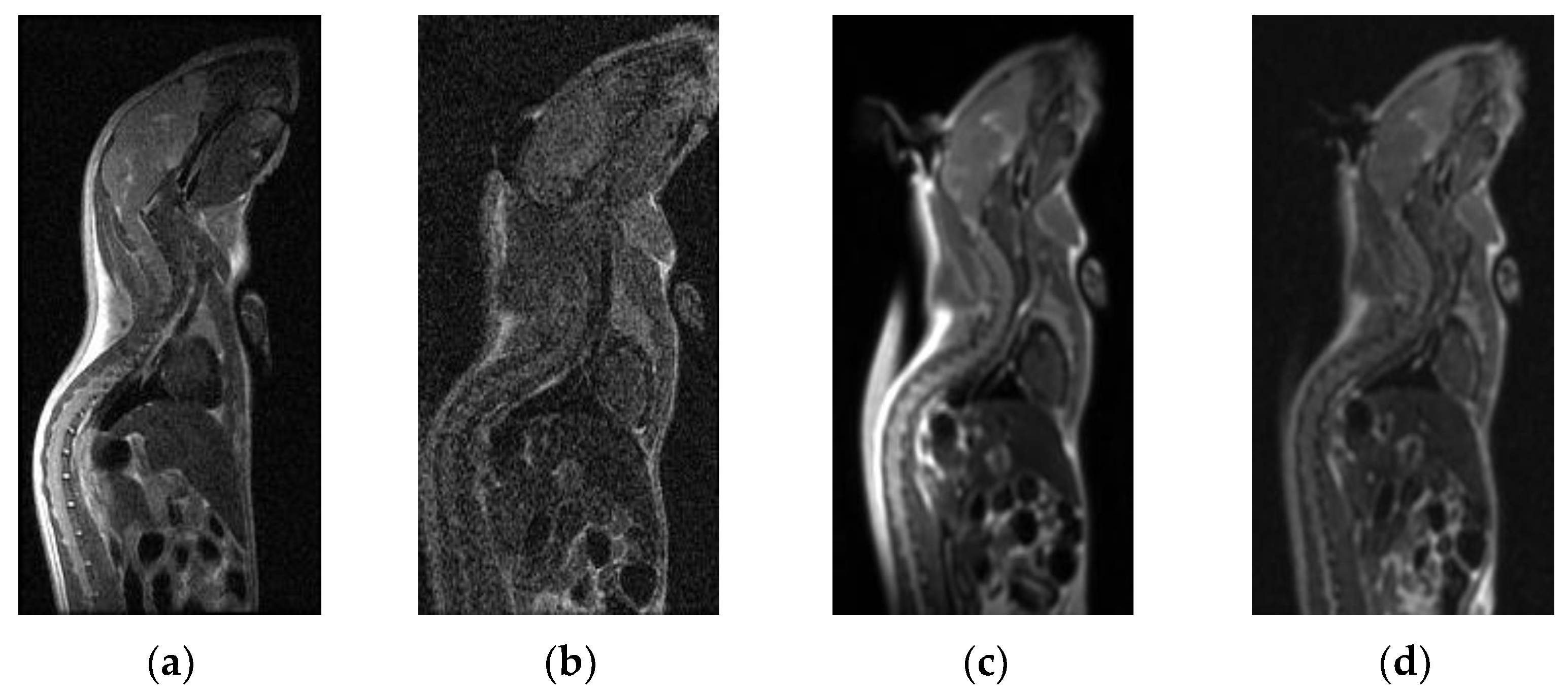 Tomography 10 00064 g005