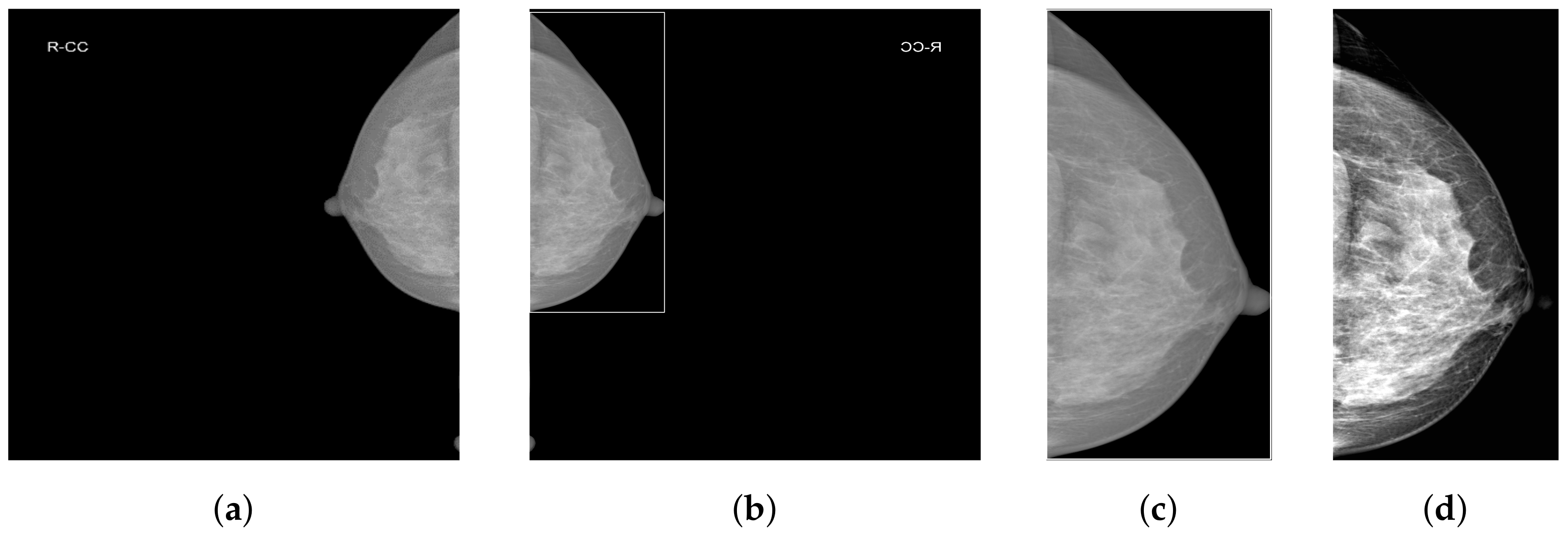 Tomography 10 00065 g002