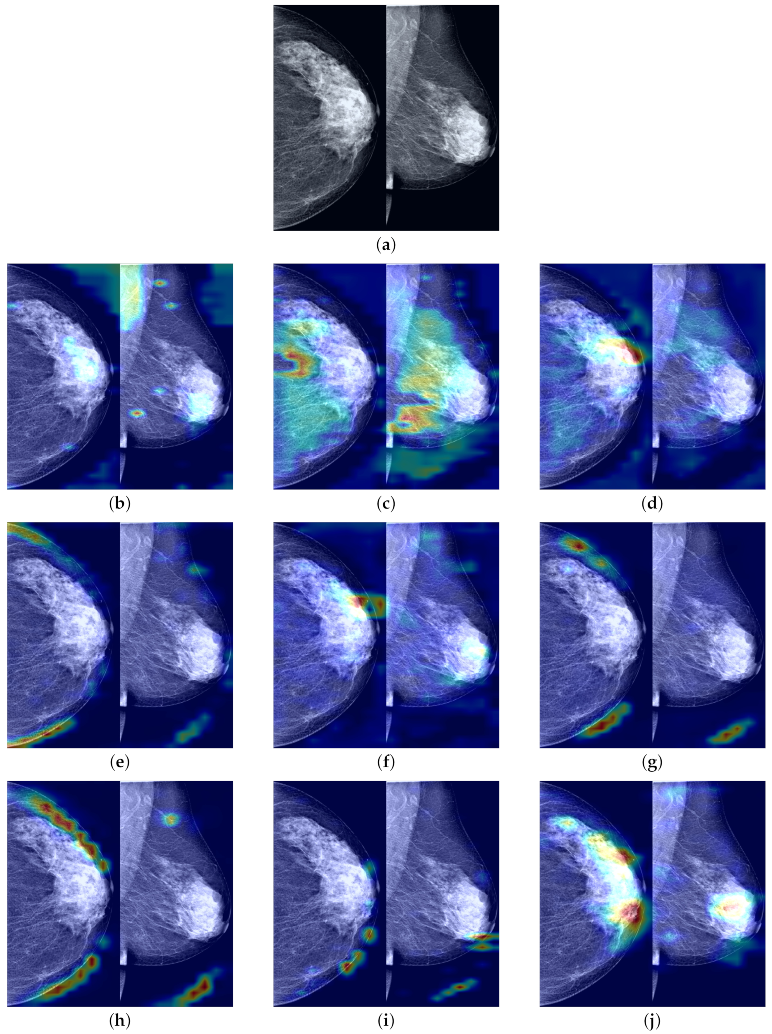 Tomography 10 00065 g011
