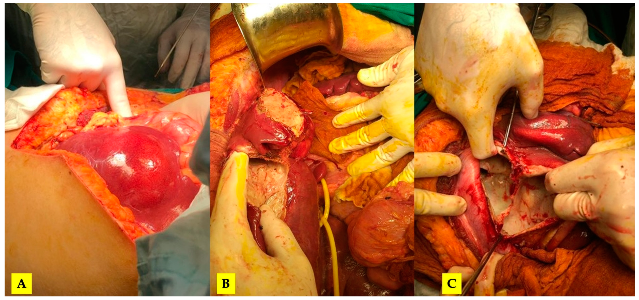 Tomography 10 00070 g002