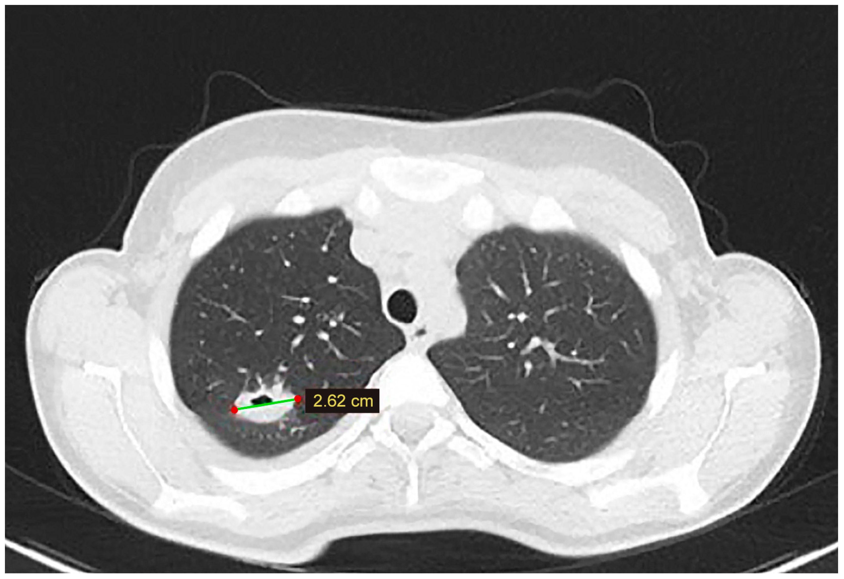 Tomography 10 00070 g003
