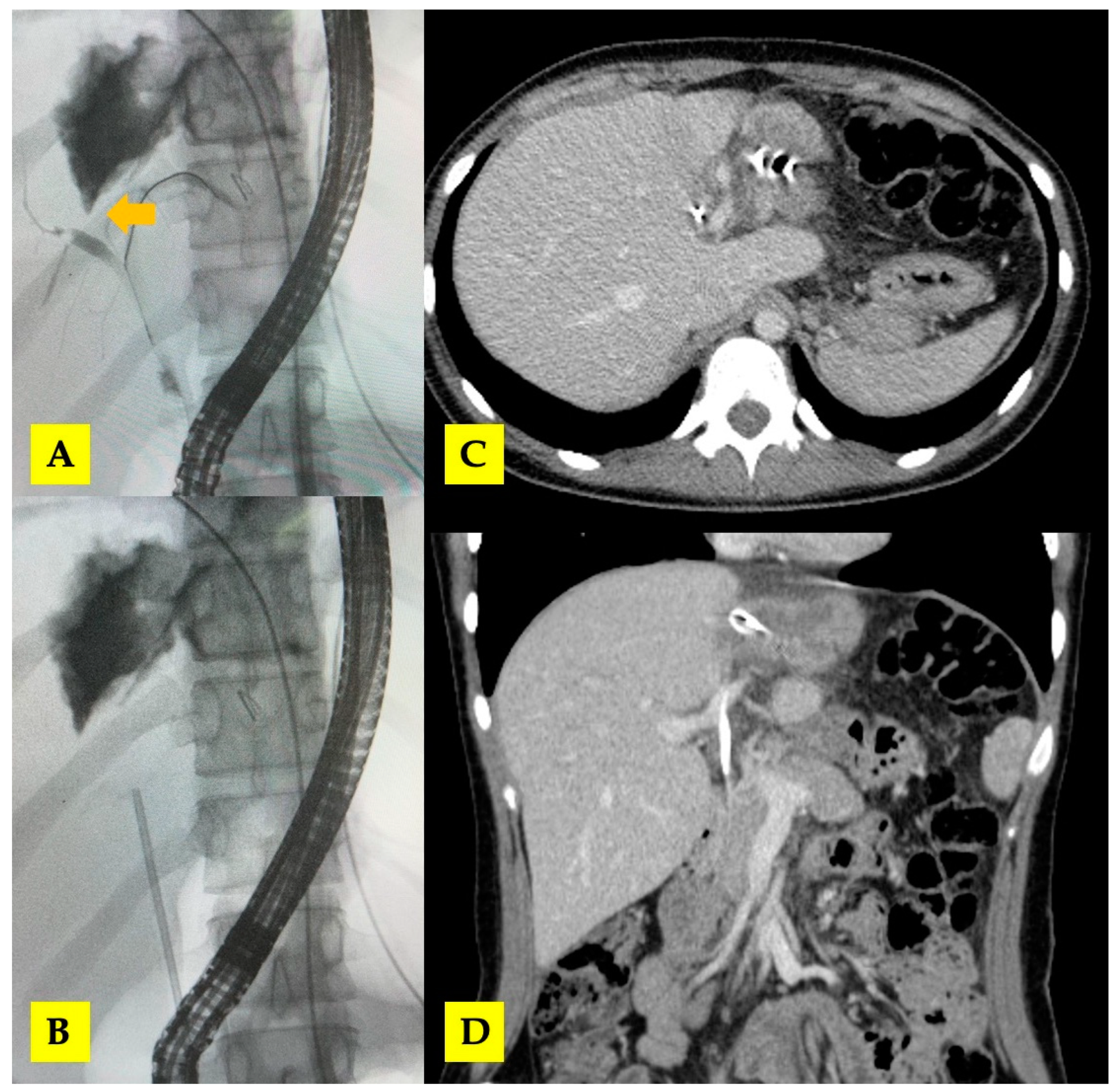 Tomography 10 00070 g006
