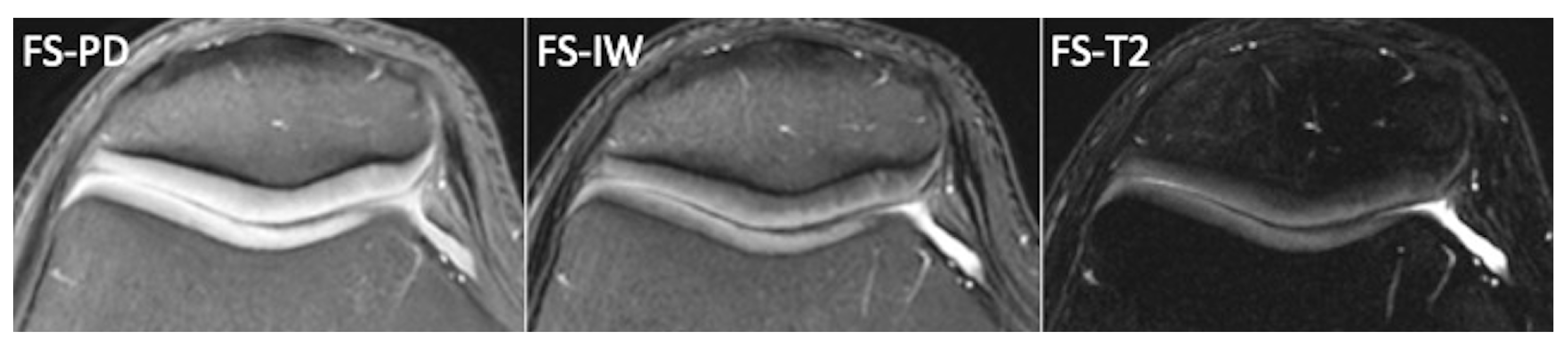 Tomography 10 00072 g002 Tomography 10 00072 g002