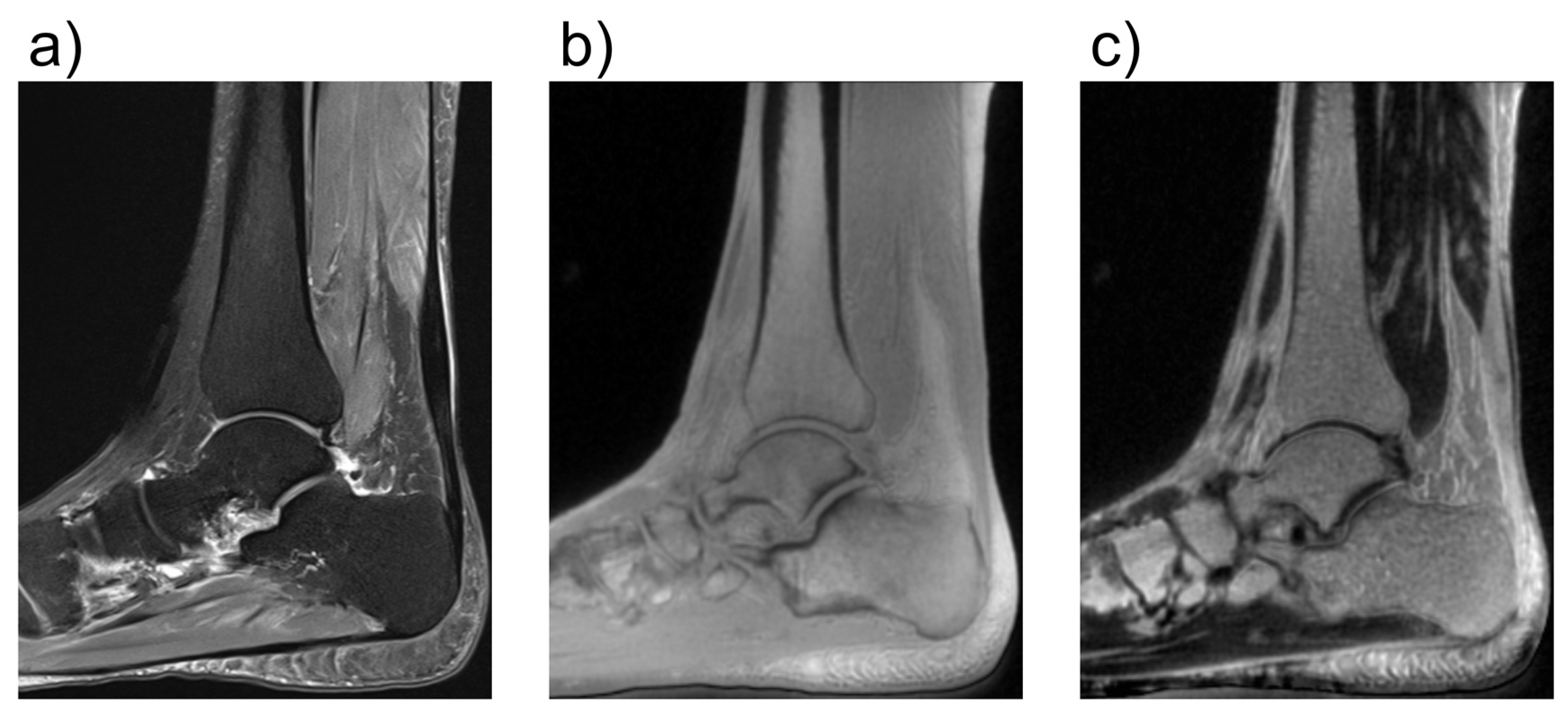 Tomography 10 00072 g007 Tomography 10 00072 g007