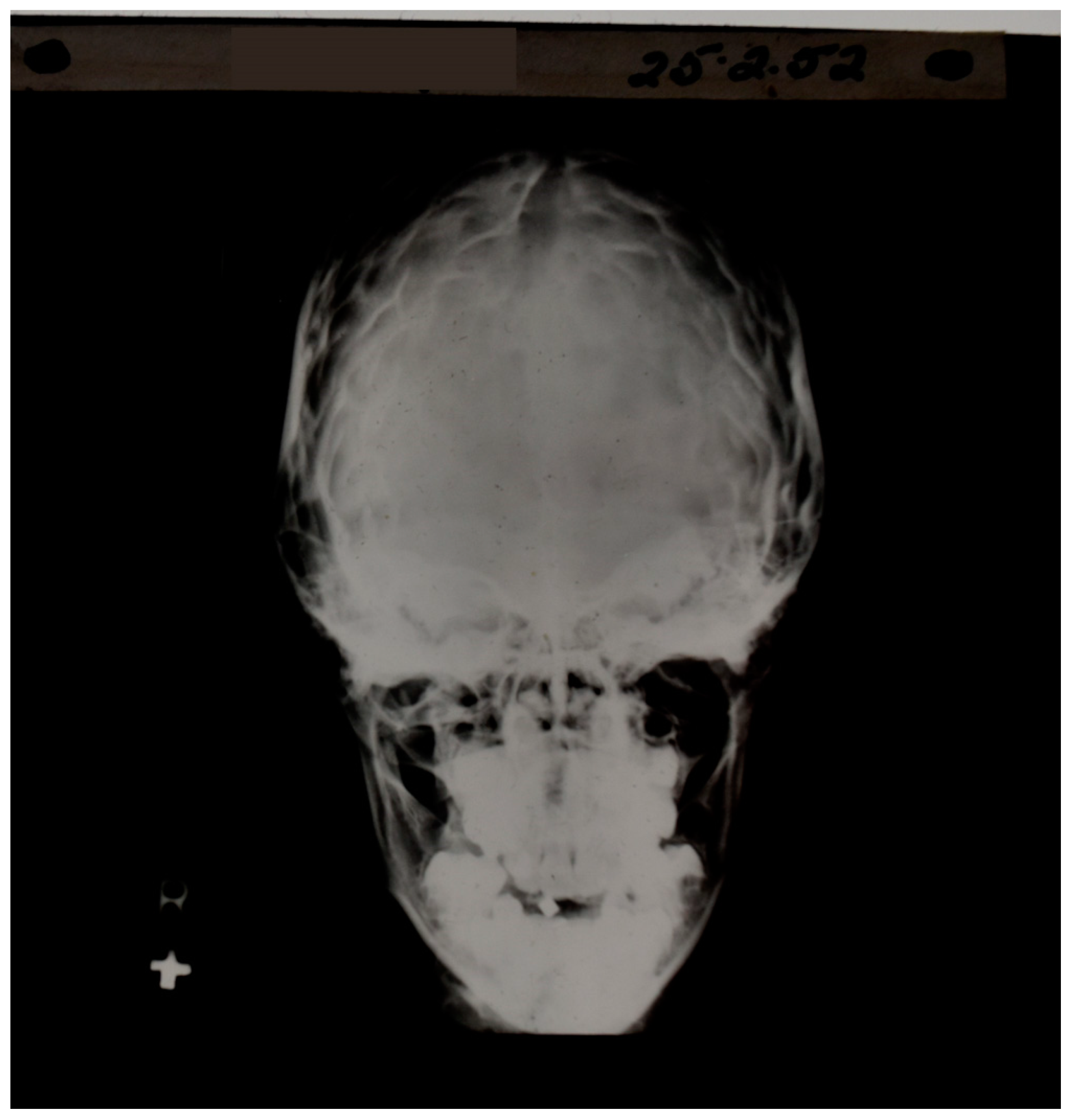 Tomography 10 00074 g002