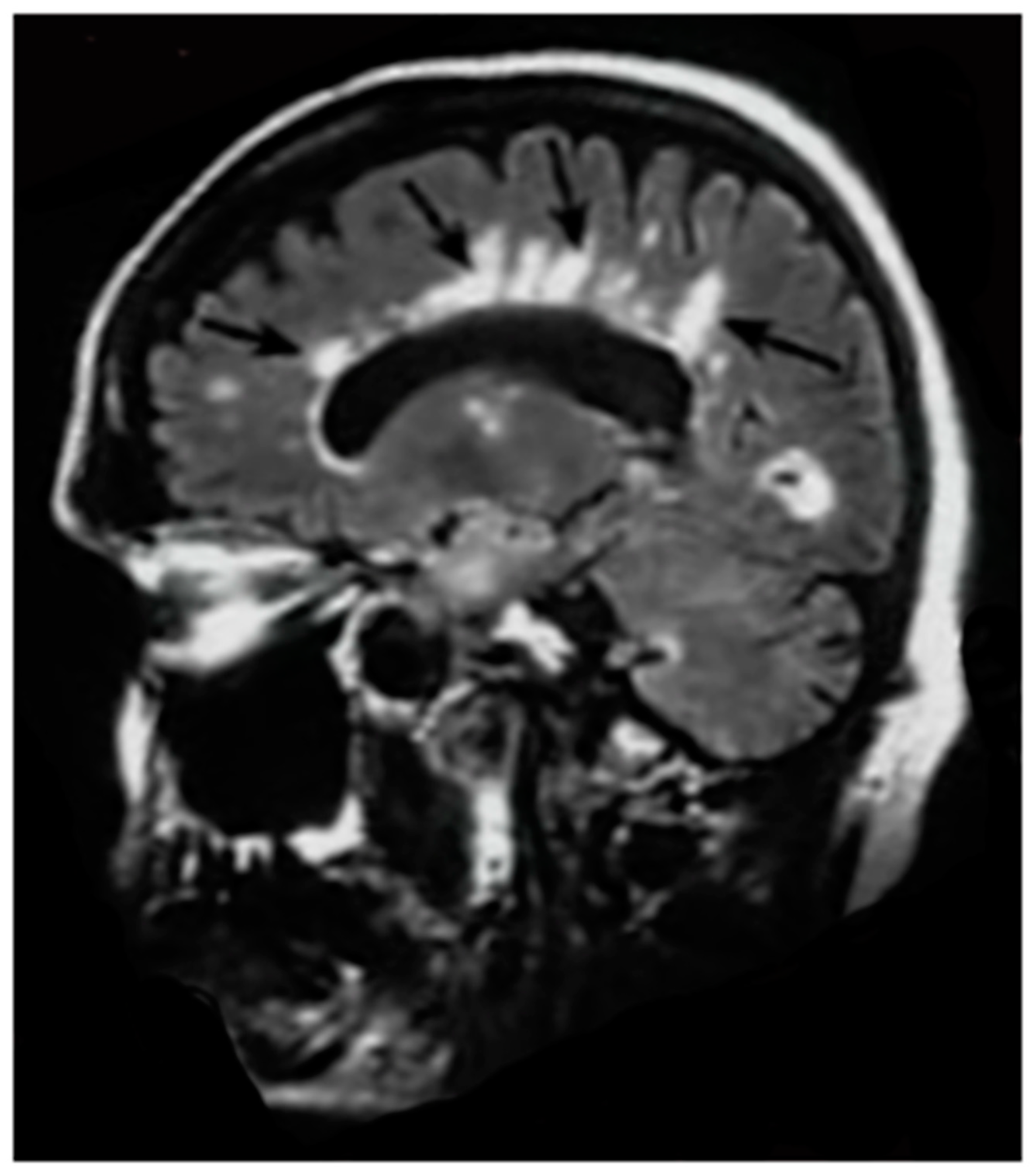 Tomography 10 00074 g011
