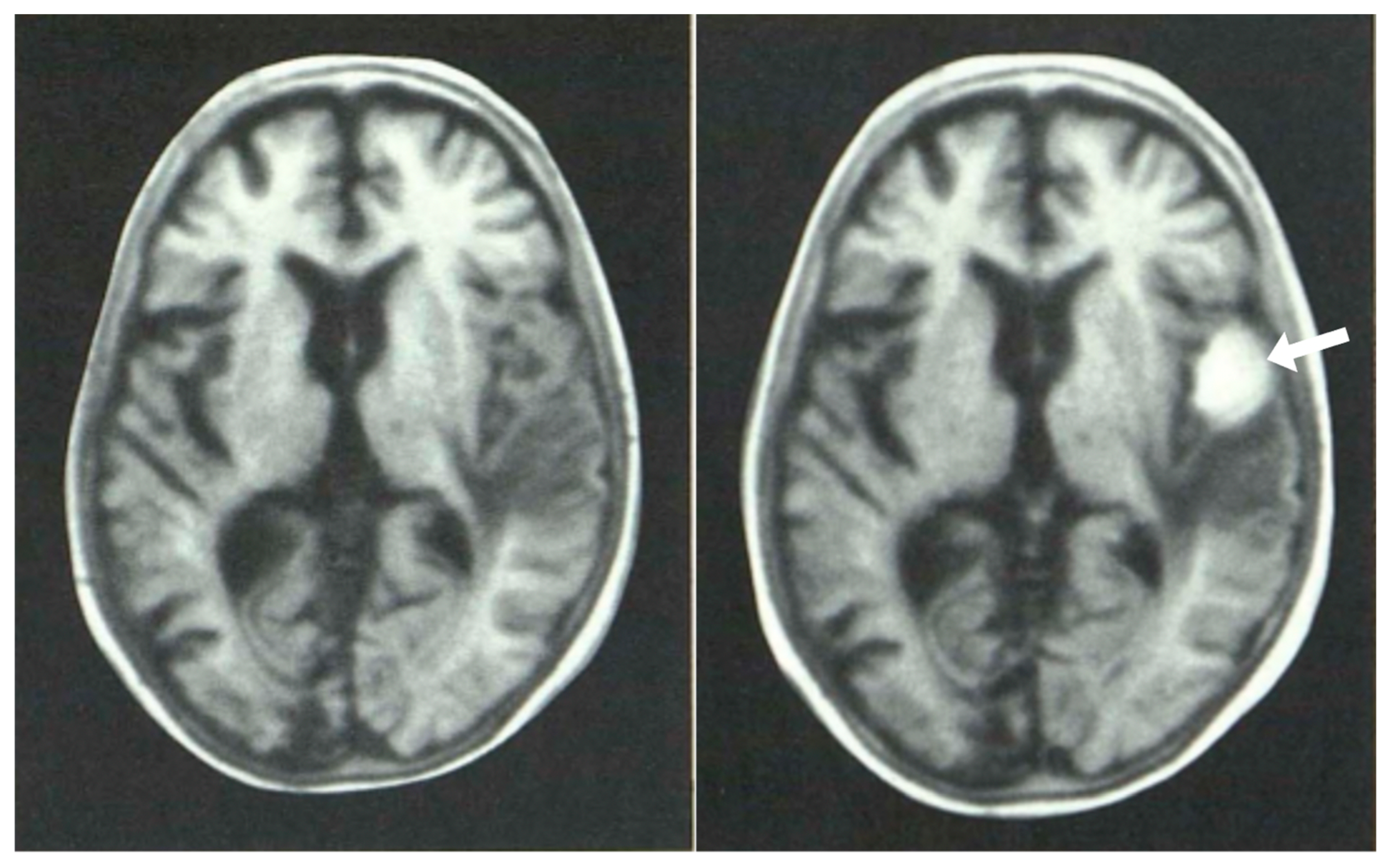 Tomography 10 00074 g012