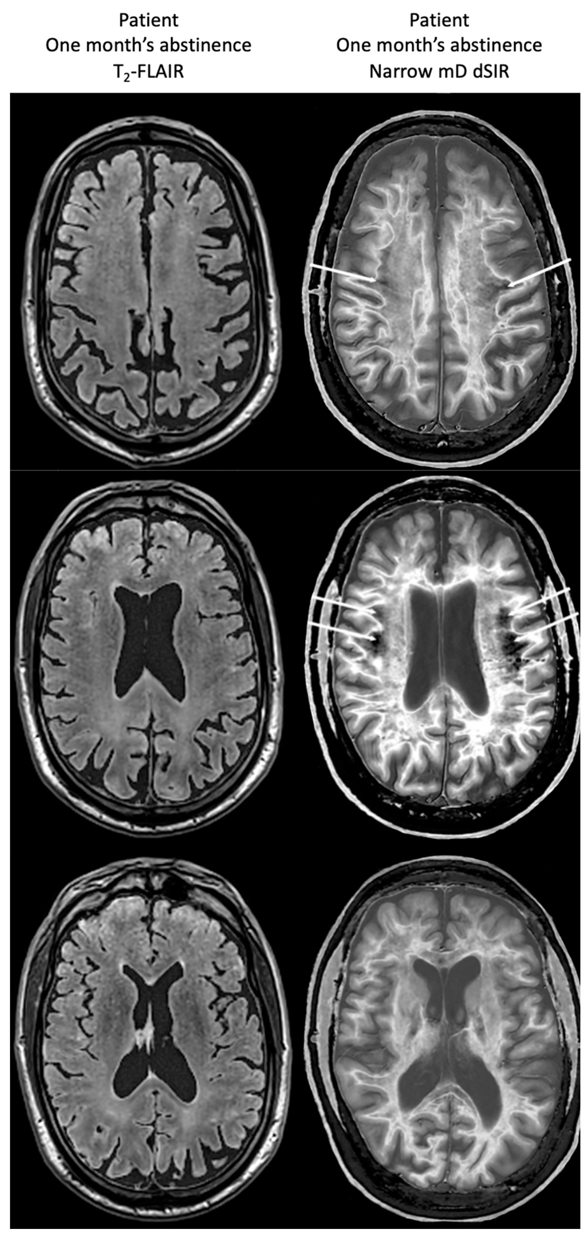Tomography 10 00074 g018