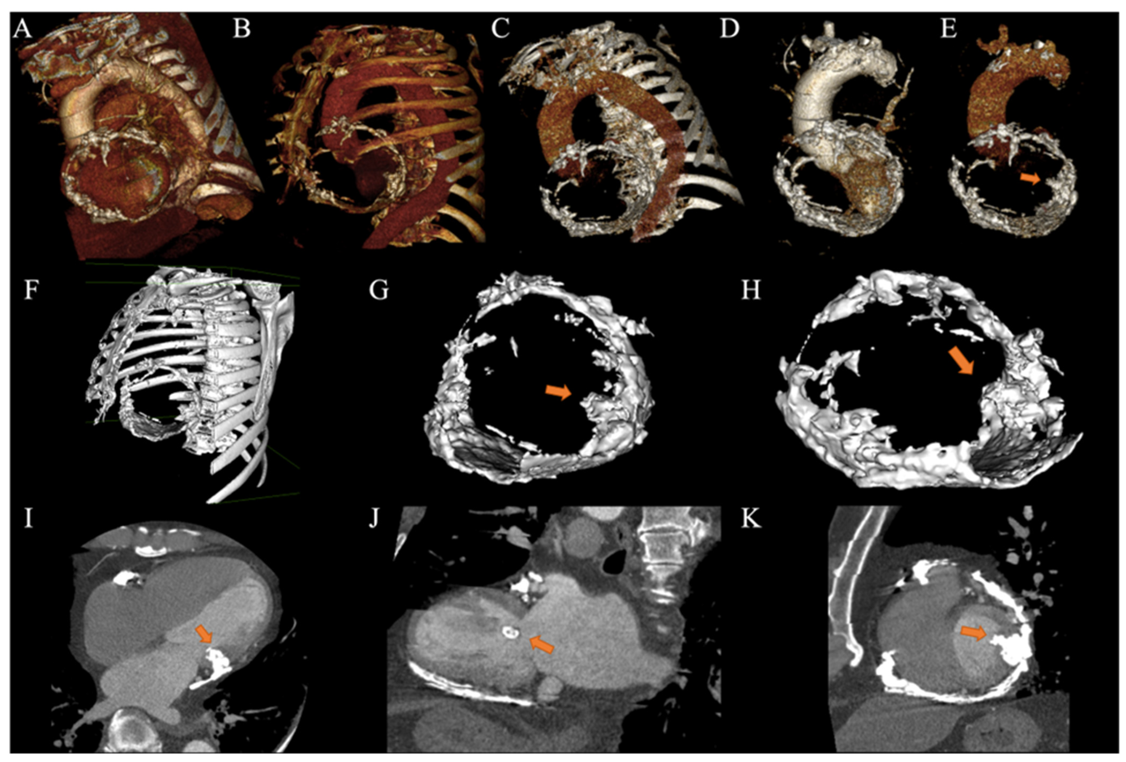 Tomography 10 00076 g003 Tomography 10 00076 g003
