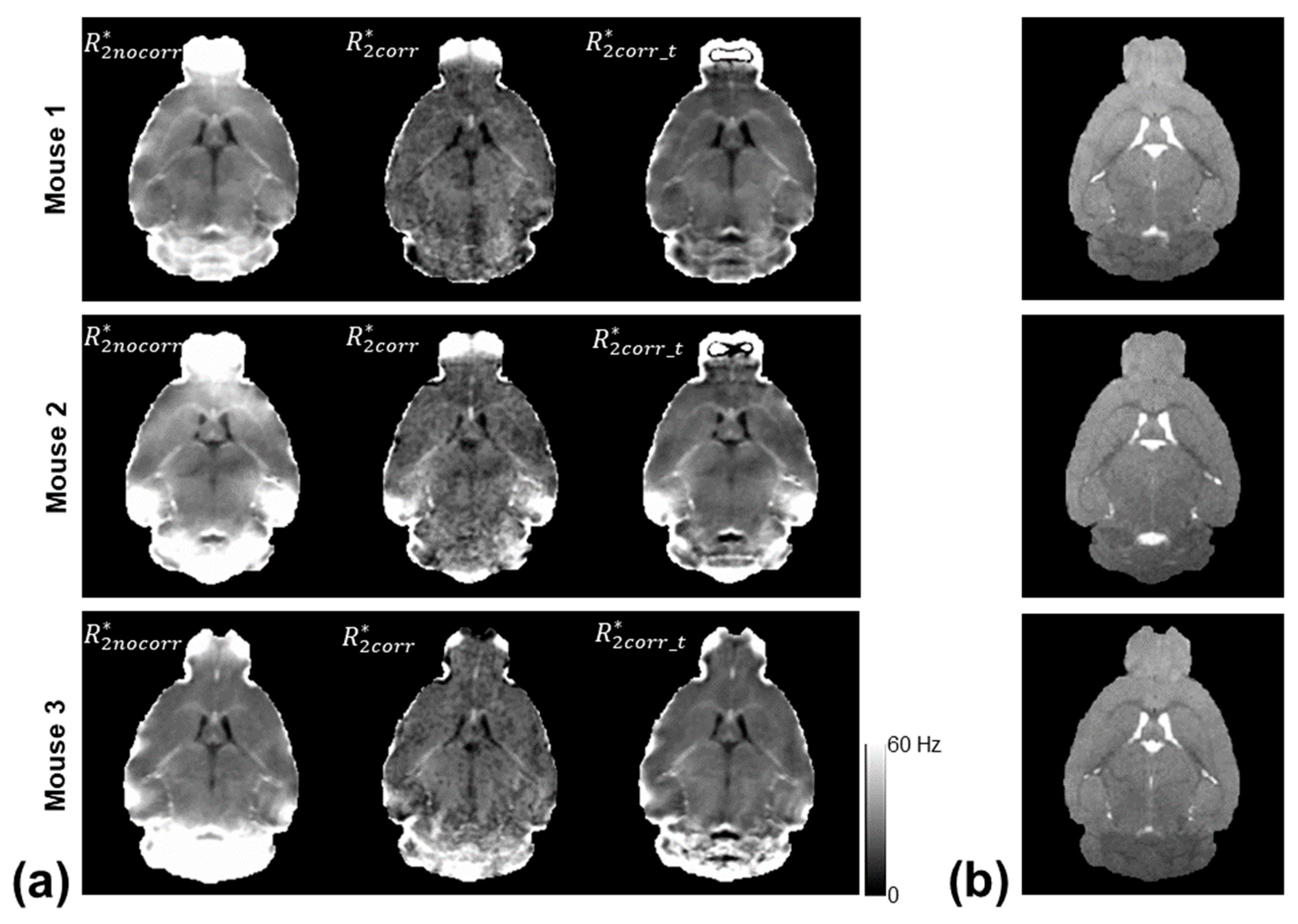 Tomography 10 00081 g002