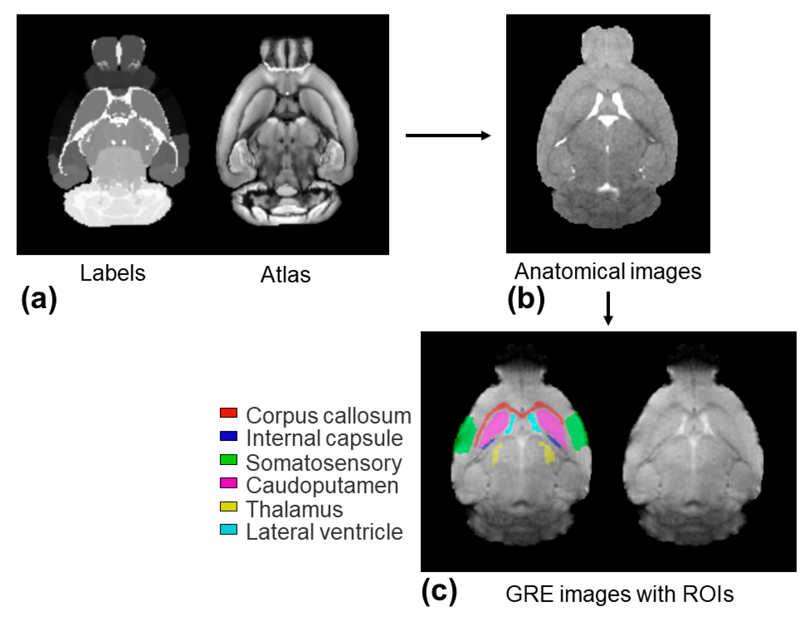 Tomography 10 00081 g004