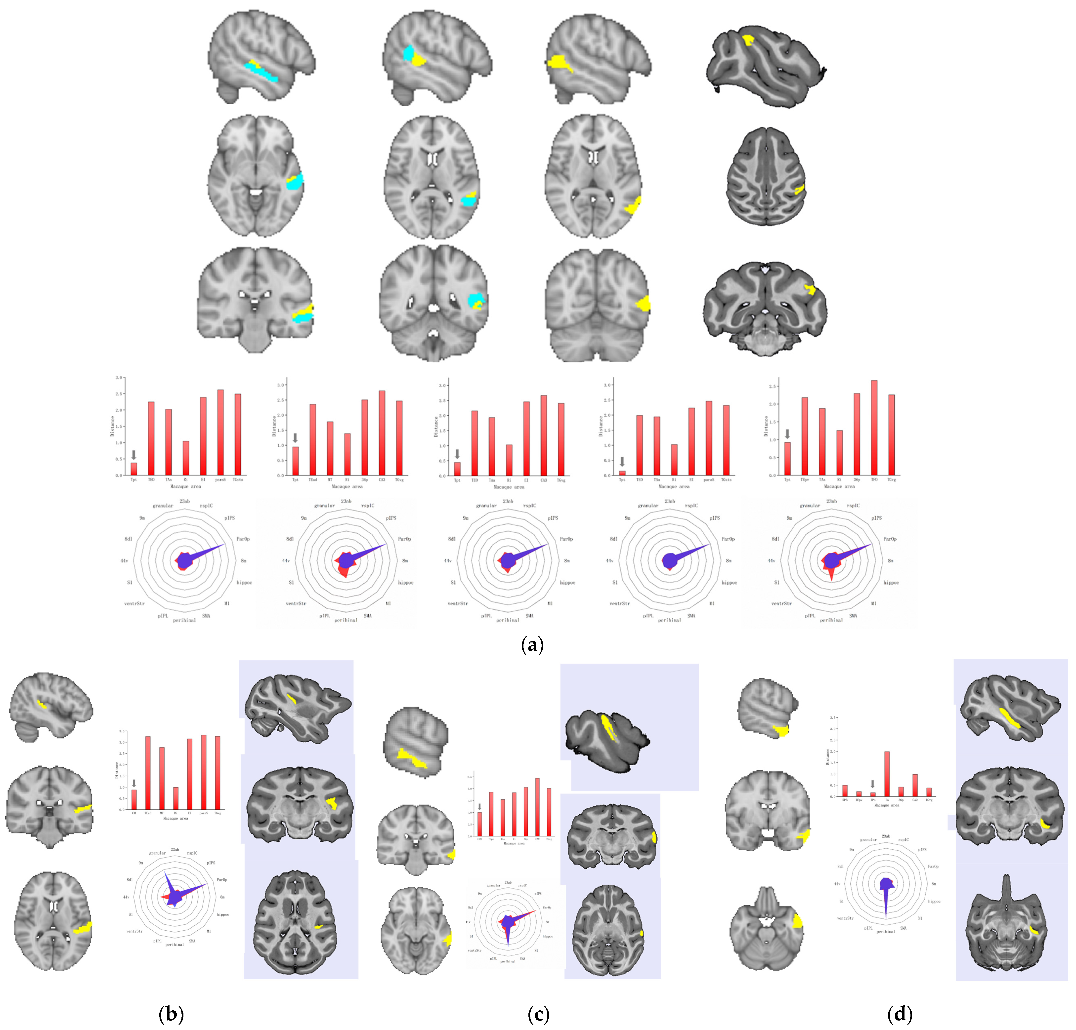 Tomography 10 00082 g003