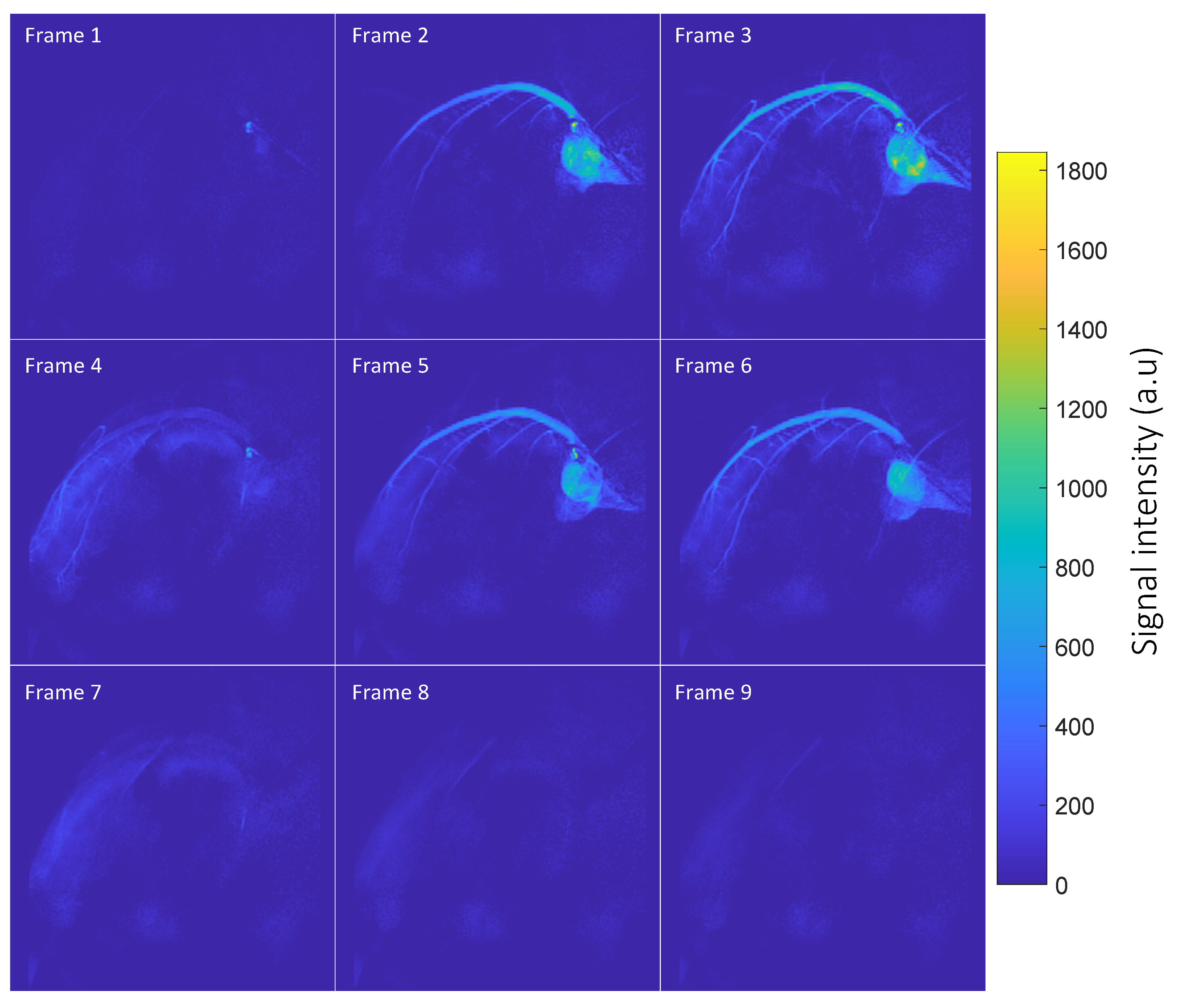 Tomography 10 00084 g001