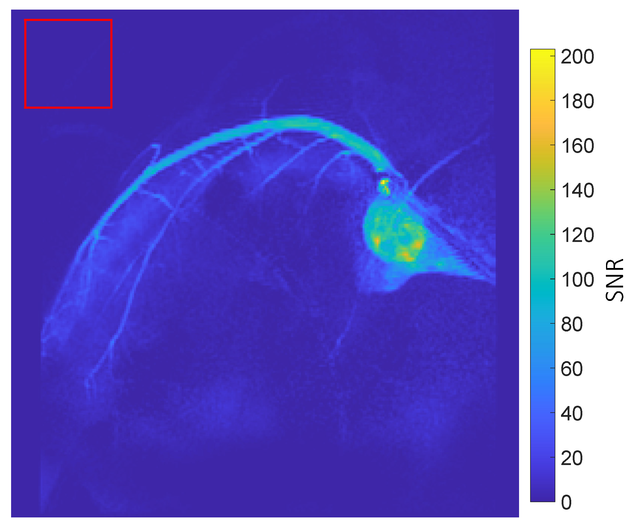 Tomography 10 00084 g002