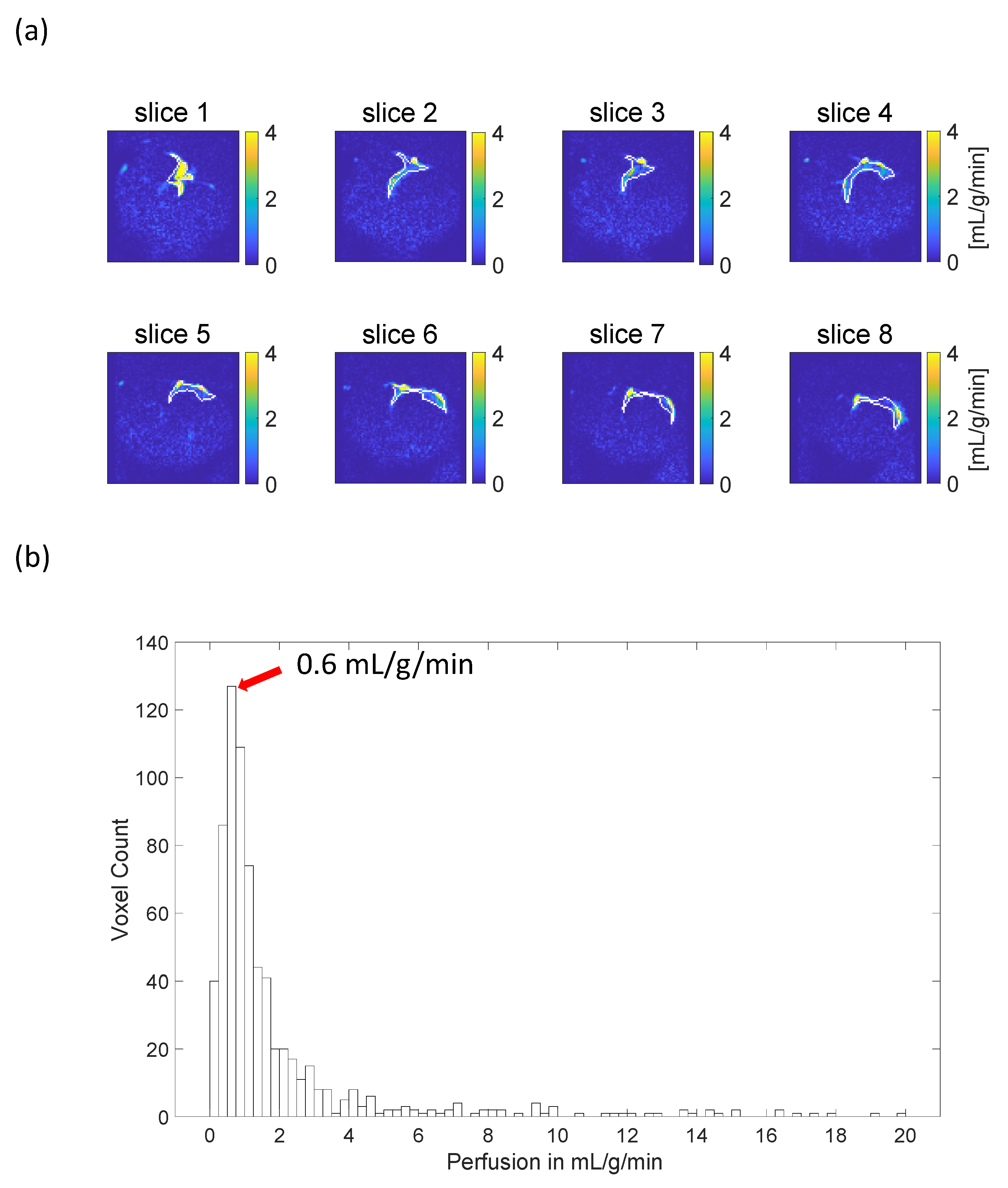 Tomography 10 00084 g005