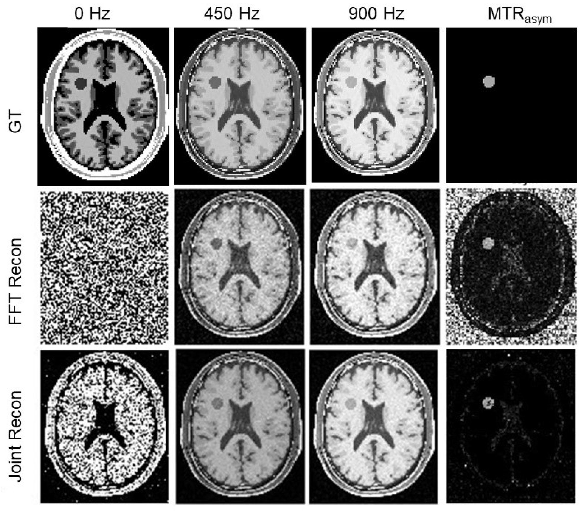 Tomography 10 00085 g005