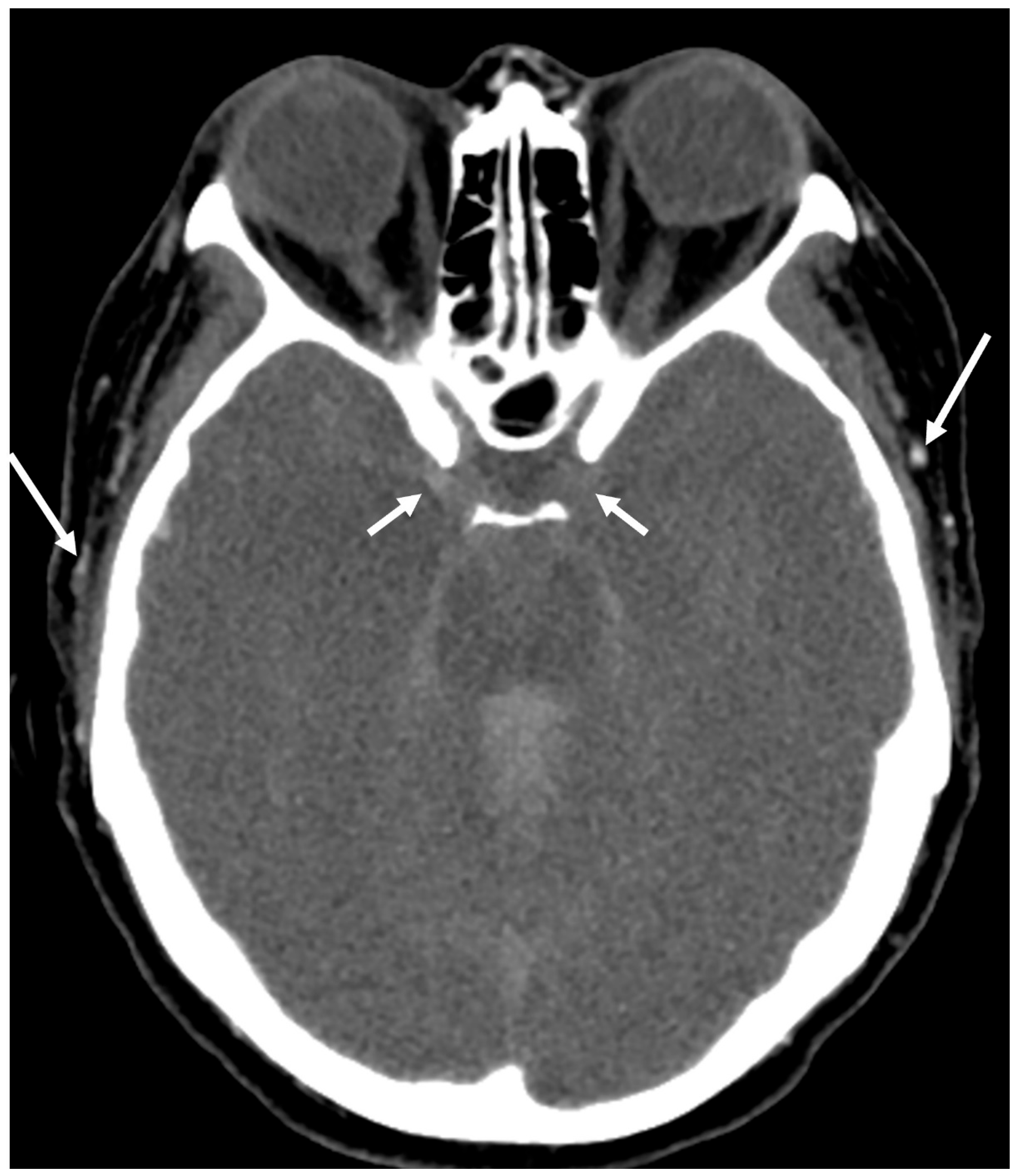 Tomography 10 00086 g001