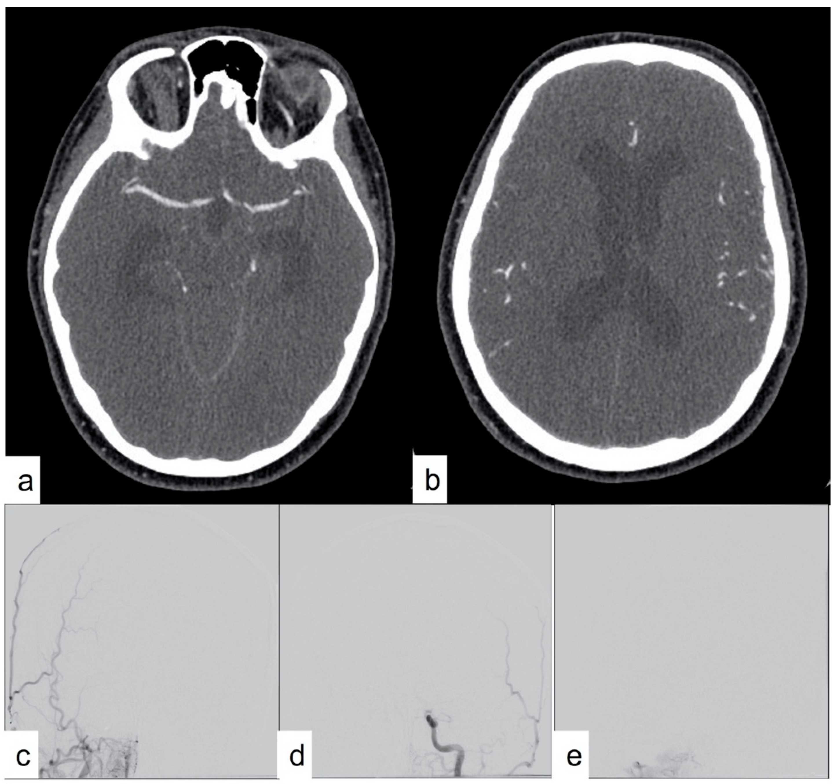Tomography 10 00086 g003