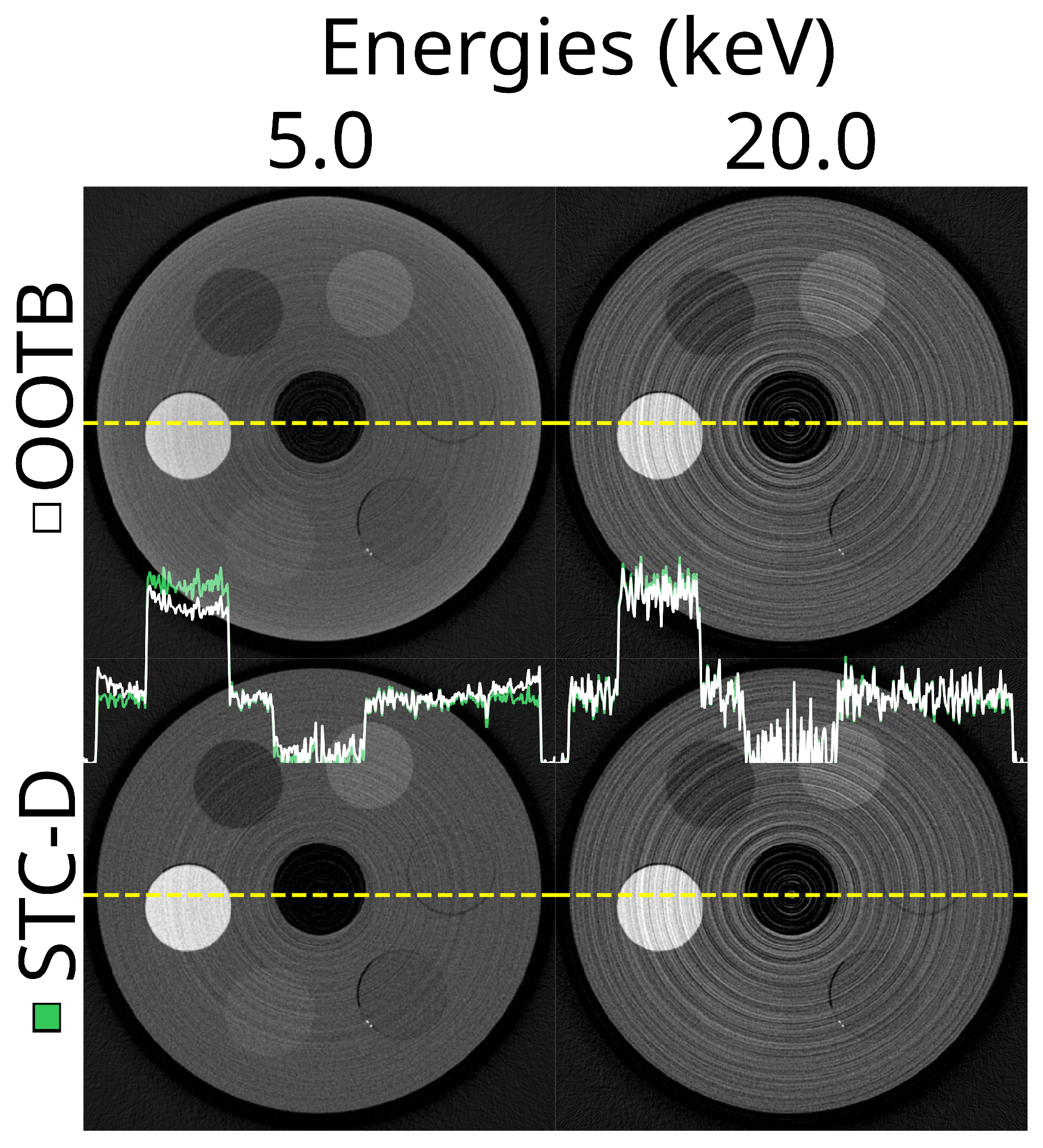 Tomography 10 00089 g006