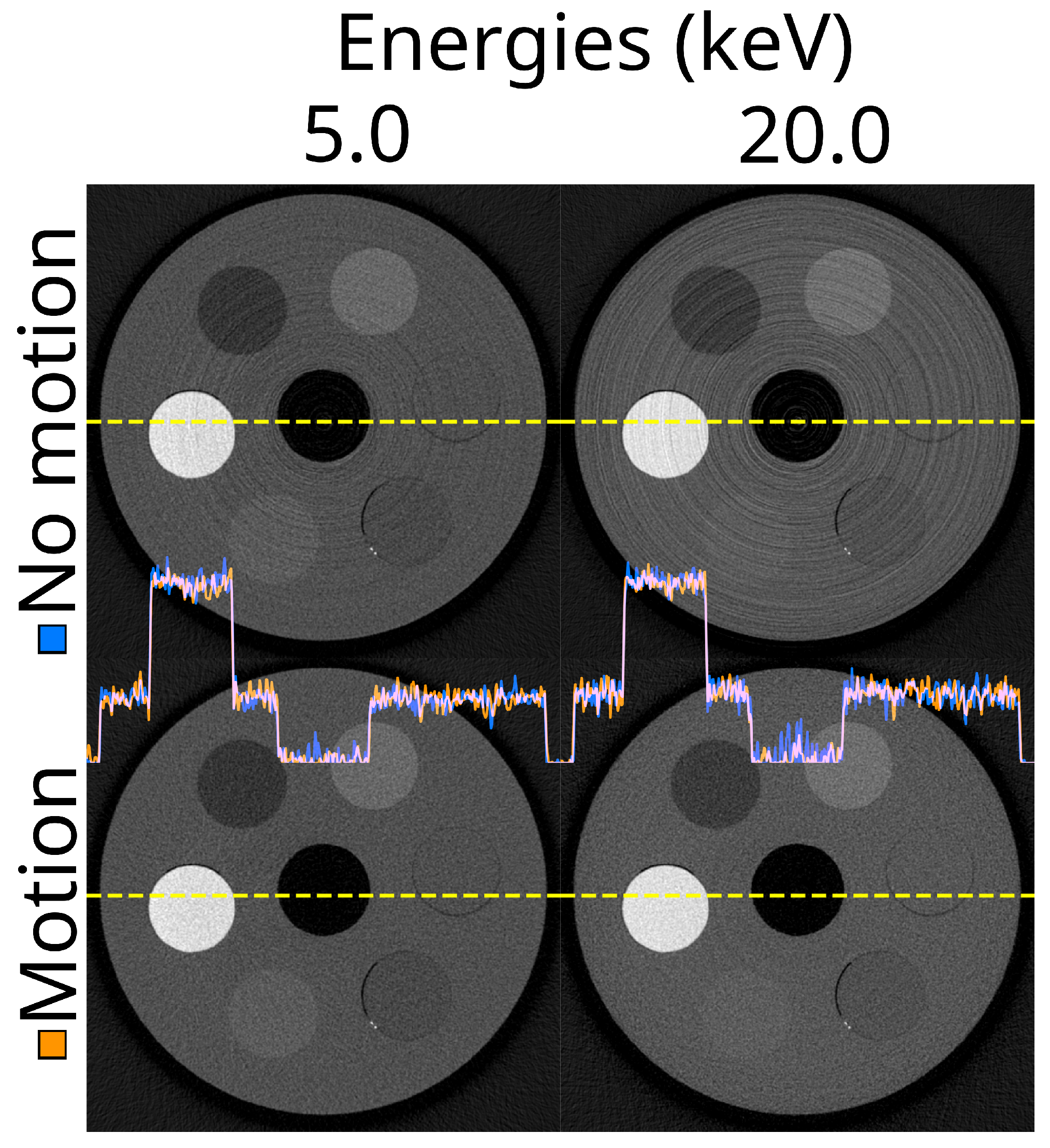 Tomography 10 00089 g008