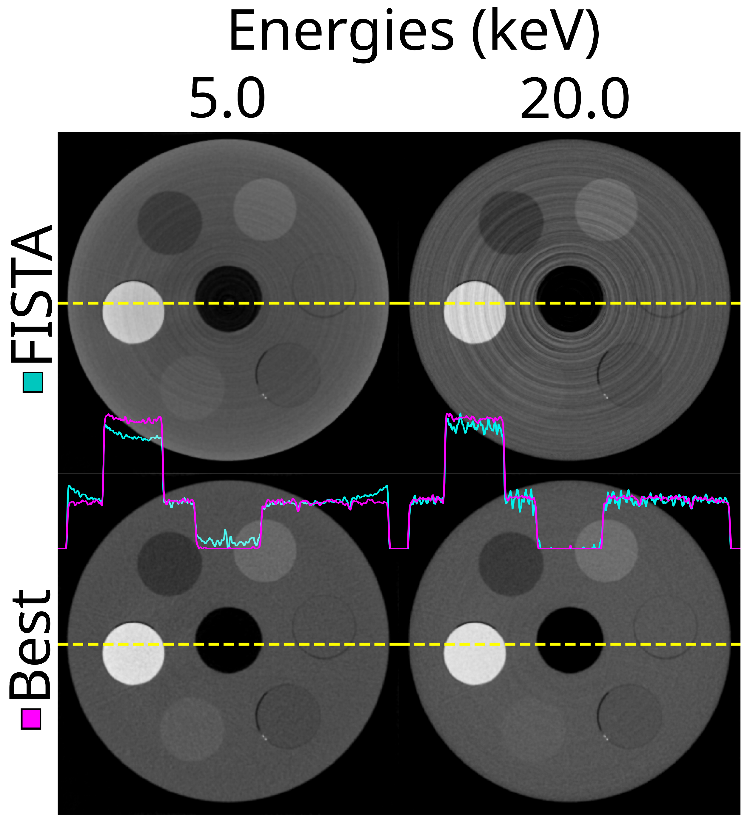 Tomography 10 00089 g017