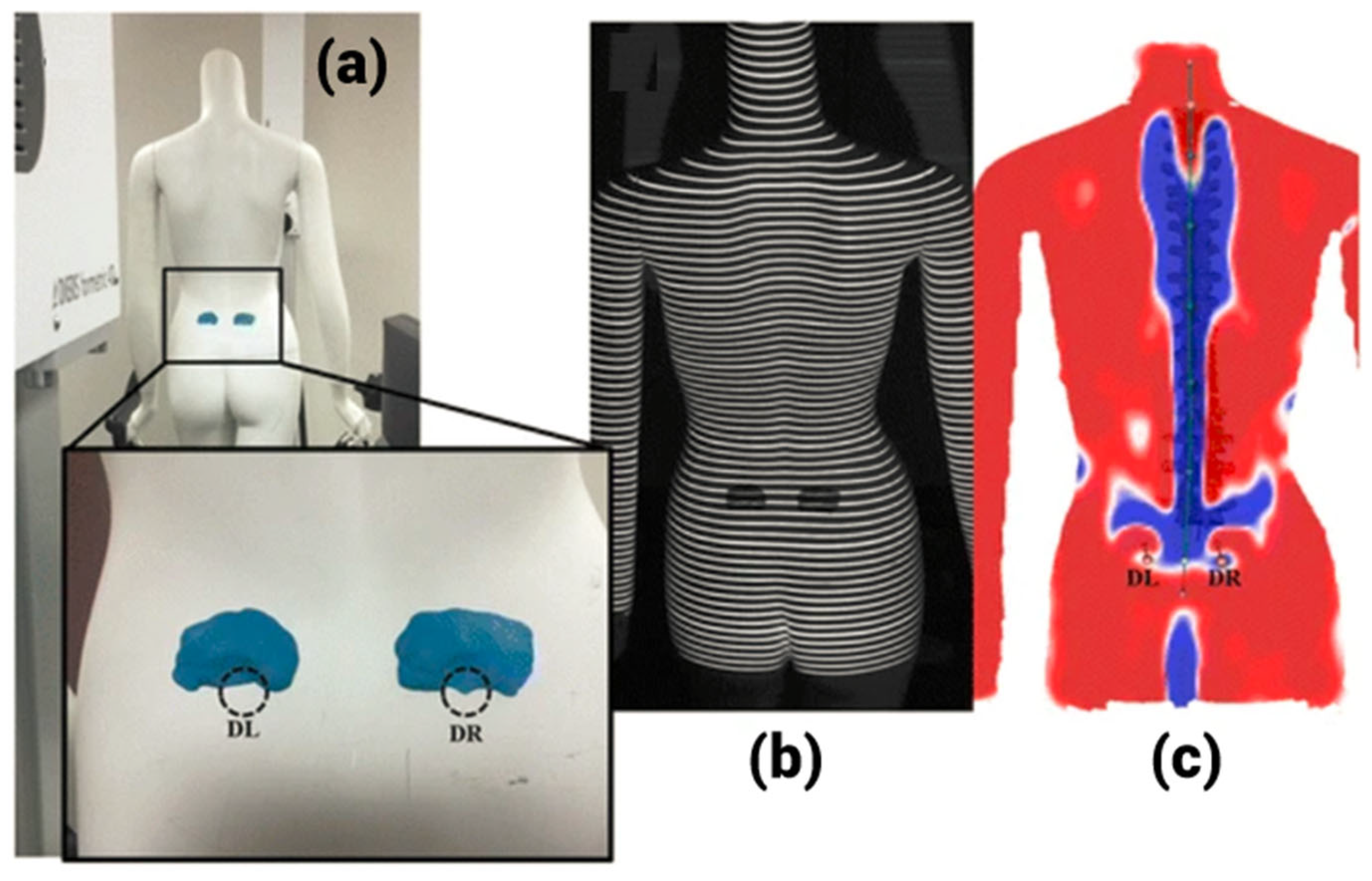 Tomography 10 00090 g005