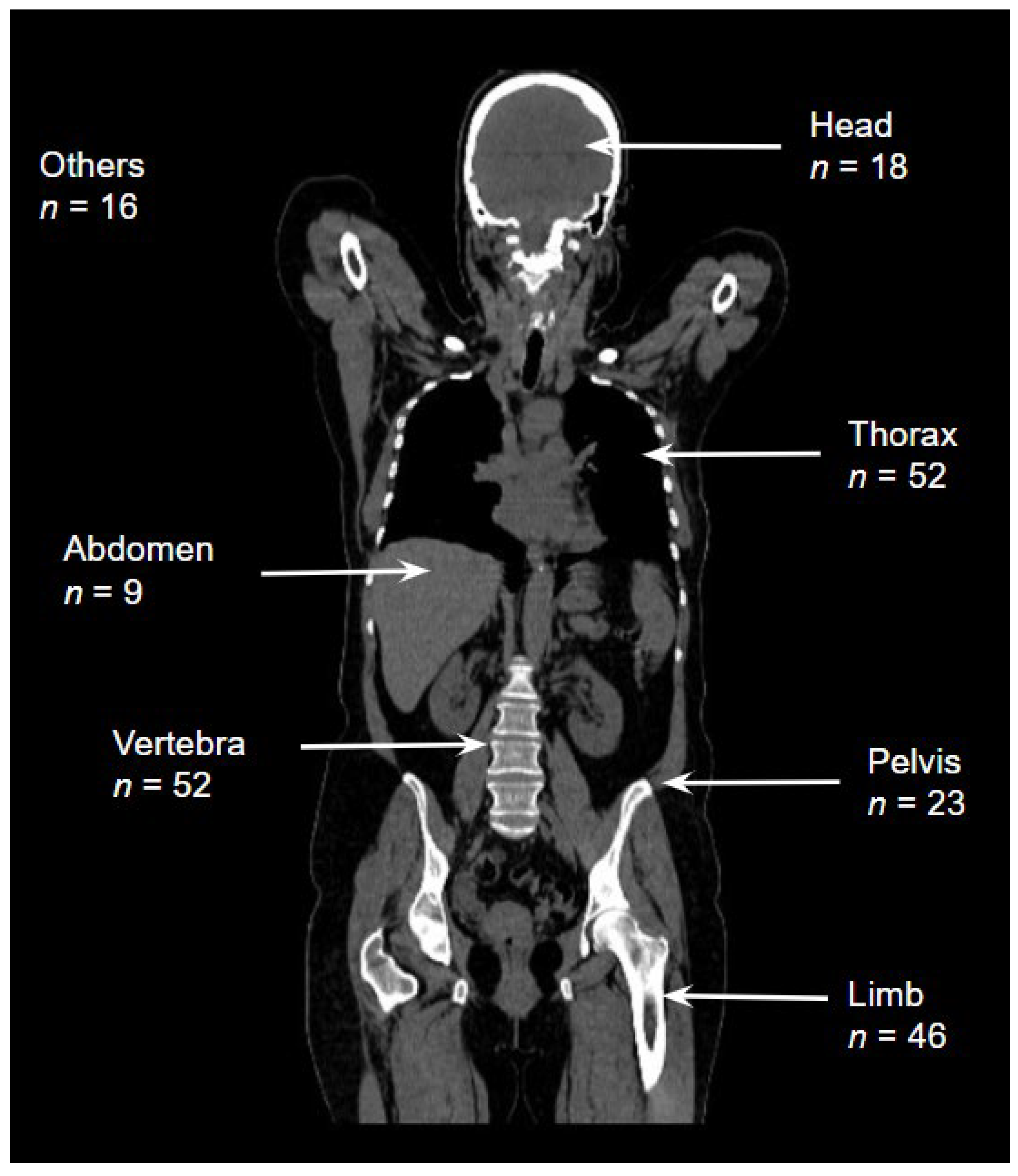Tomography 10 00099 g001 Tomography 10 00099 g001