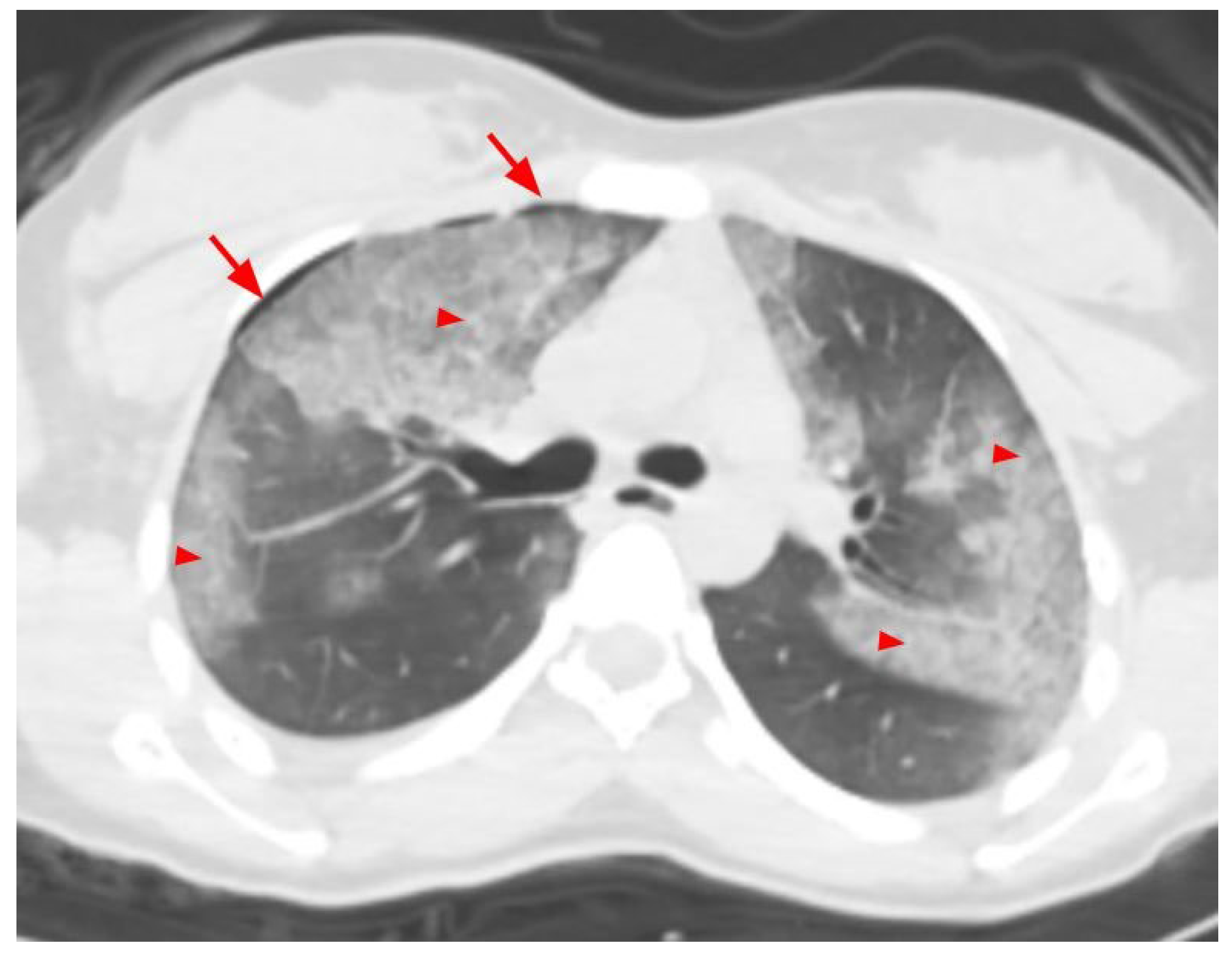 Tomography 10 00099 g003 Tomography 10 00099 g003