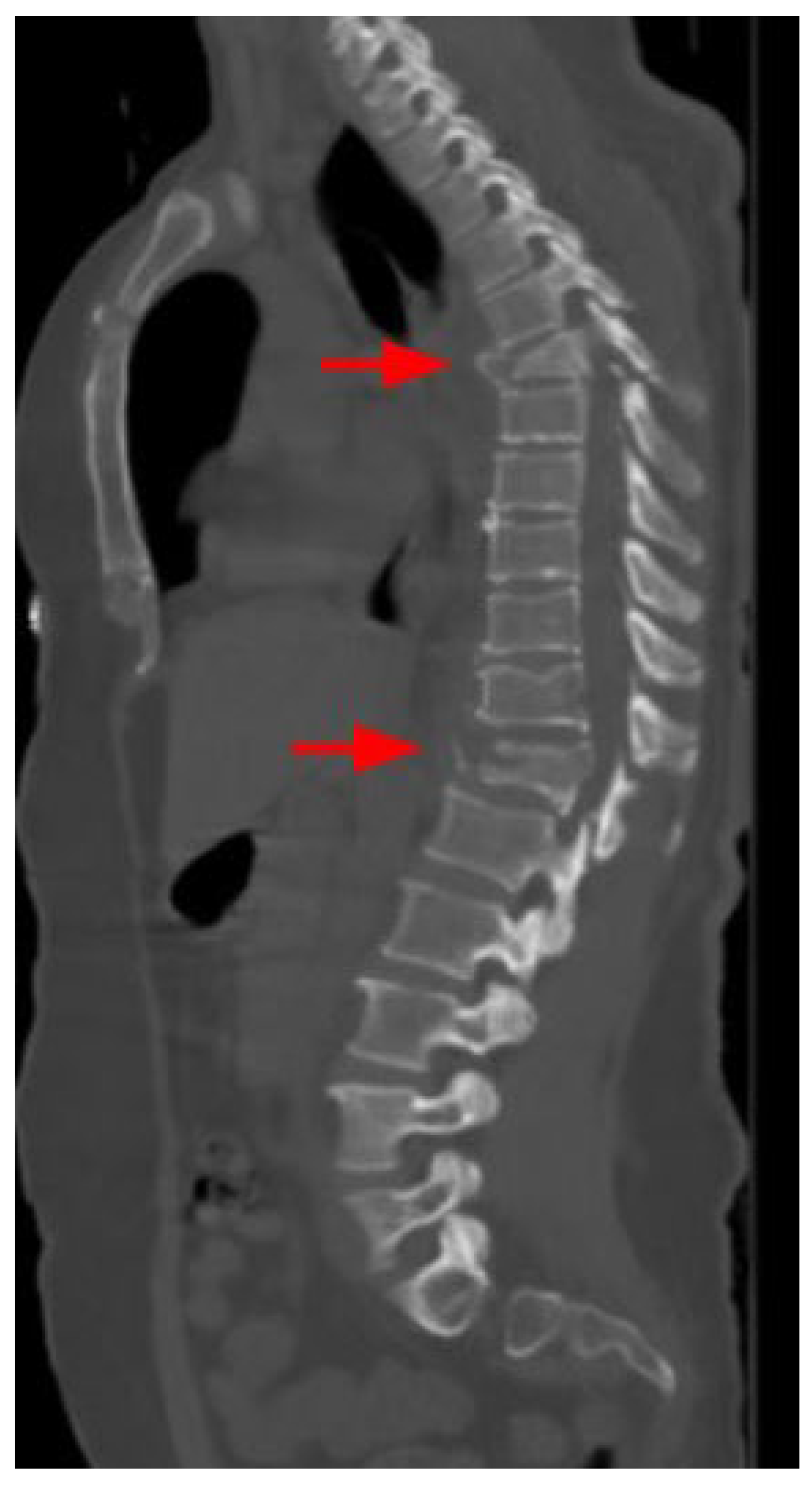 Tomography 10 00099 g004 Tomography 10 00099 g004