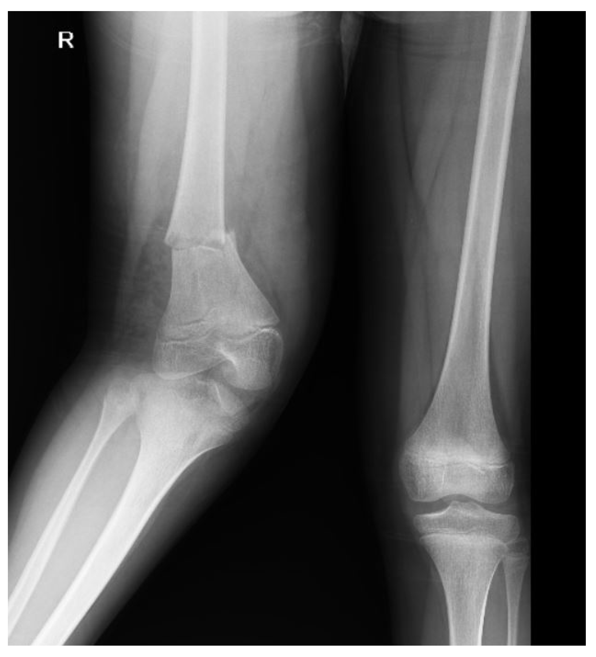 Tomography 10 00099 g005 Tomography 10 00099 g005