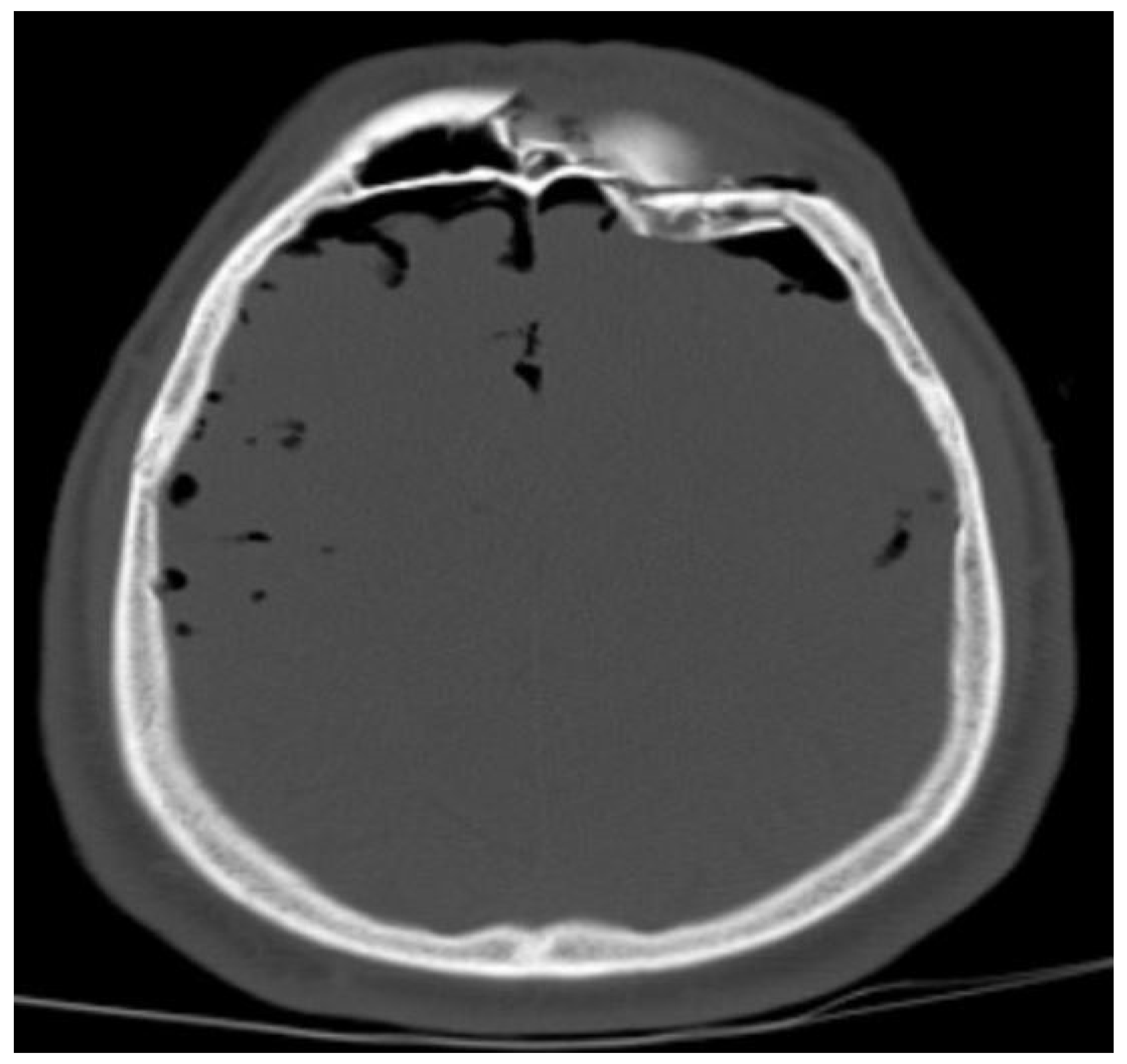 Tomography 10 00099 g006 Tomography 10 00099 g006