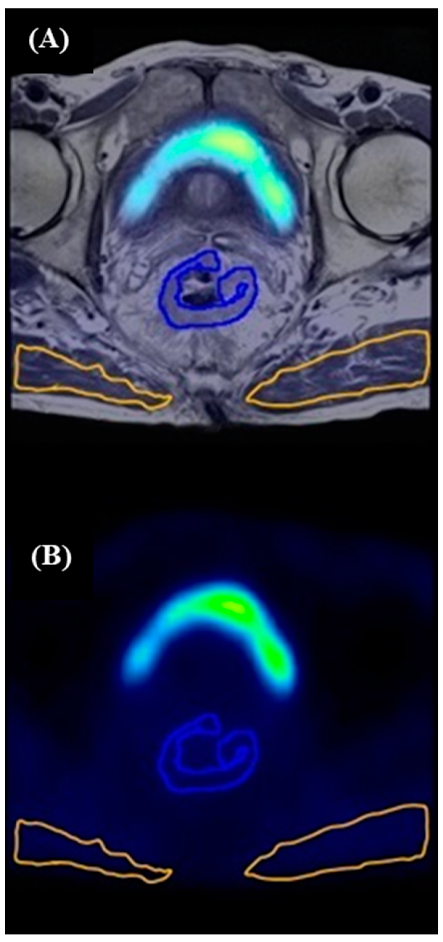 Tomography 10 00102 g001