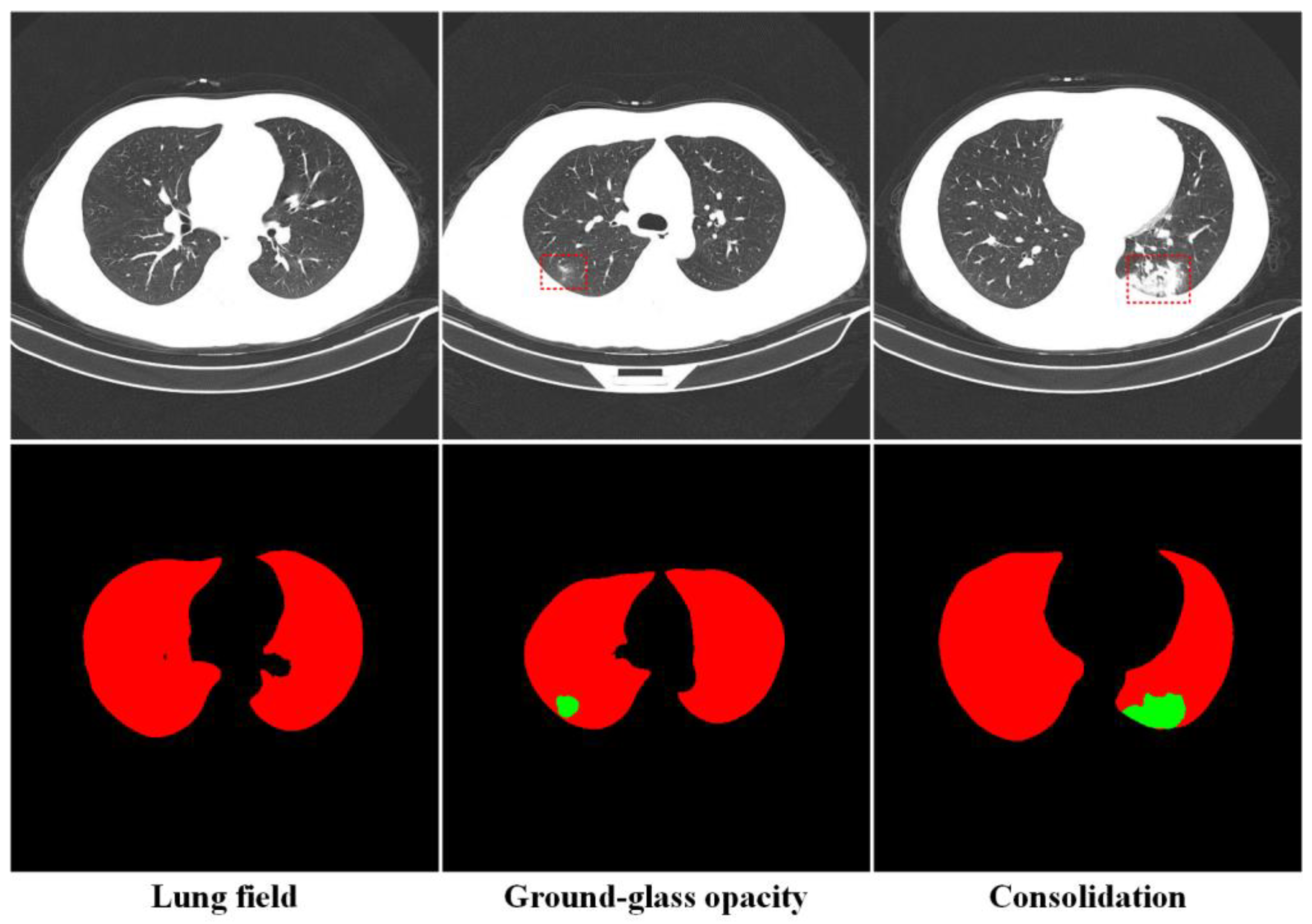 Tomography 10 00109 g002