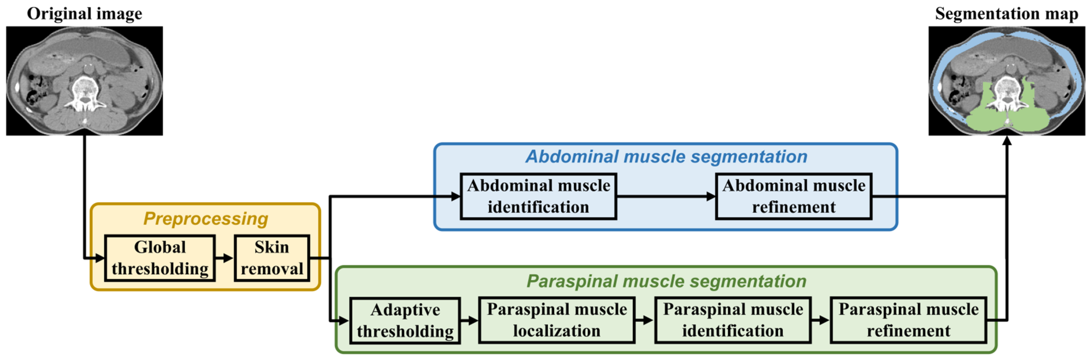 Tomography 10 00111 g002