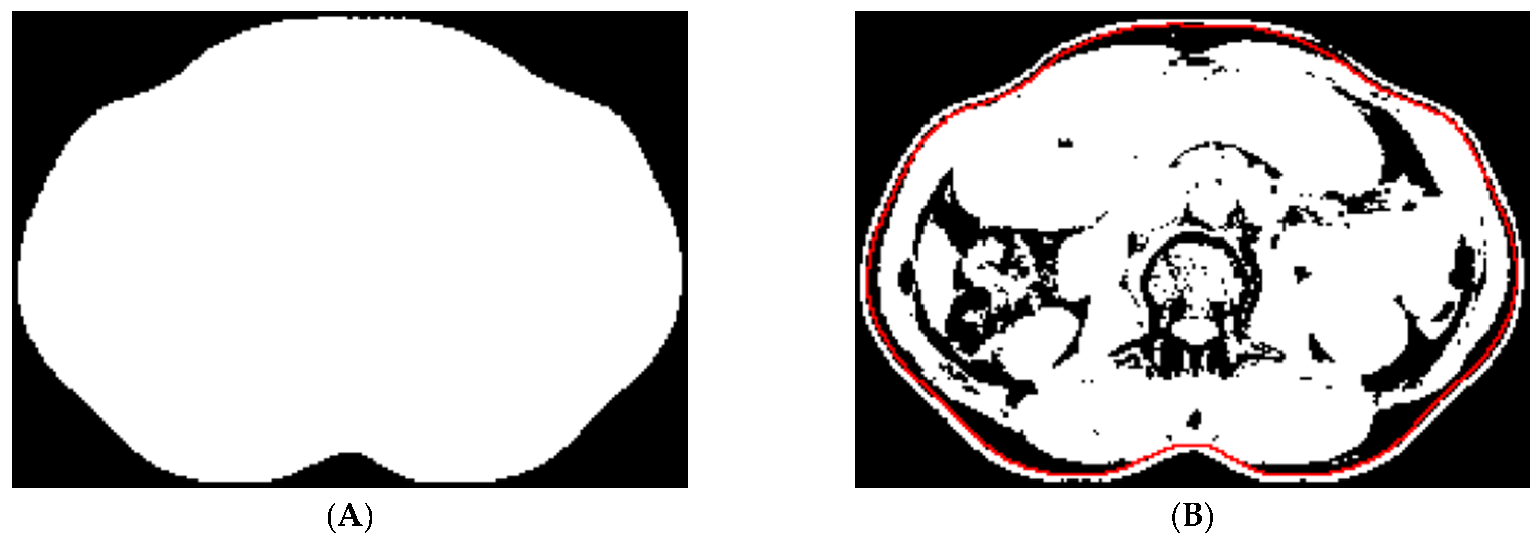 Tomography 10 00111 g003