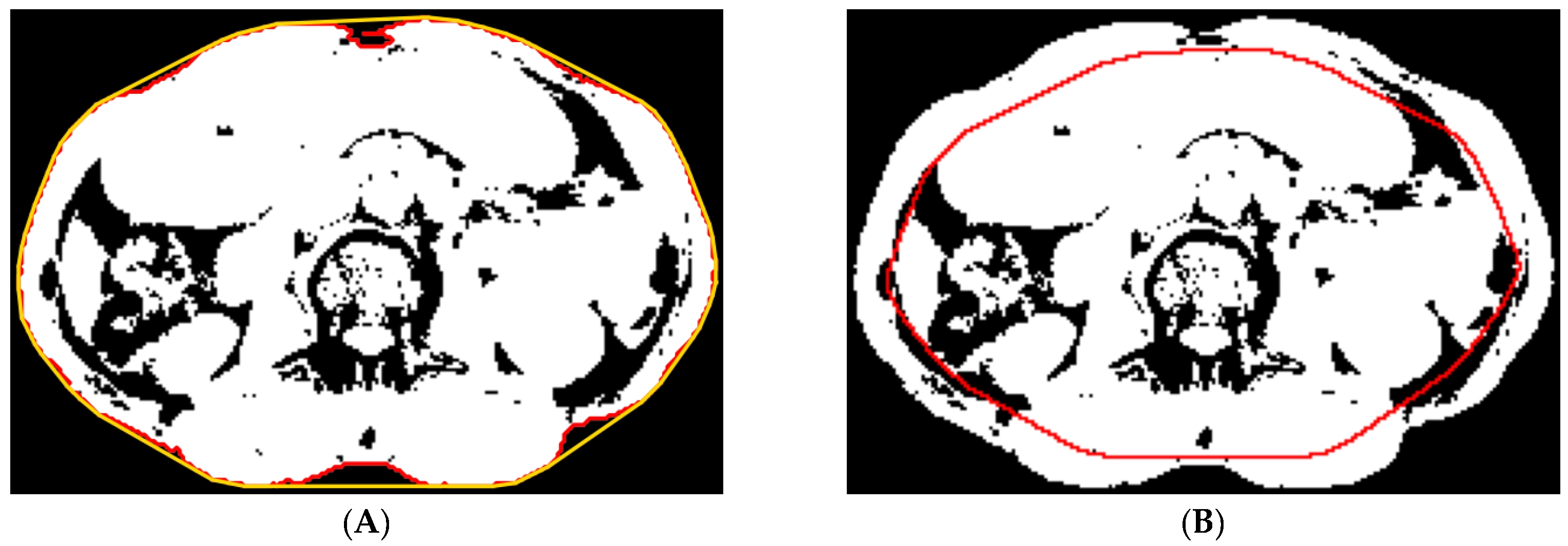 Tomography 10 00111 g004