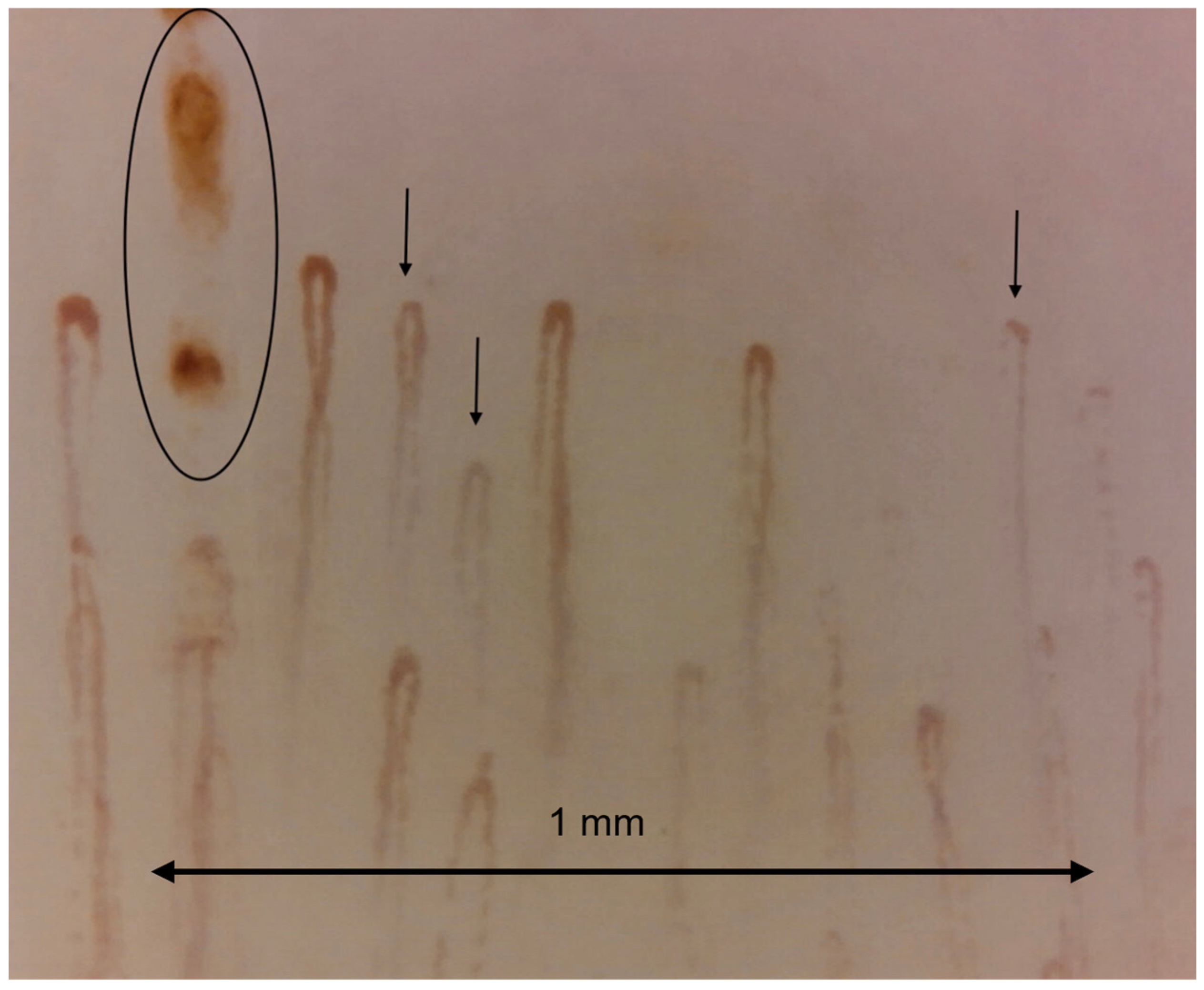 Tomography 10 00114 g004