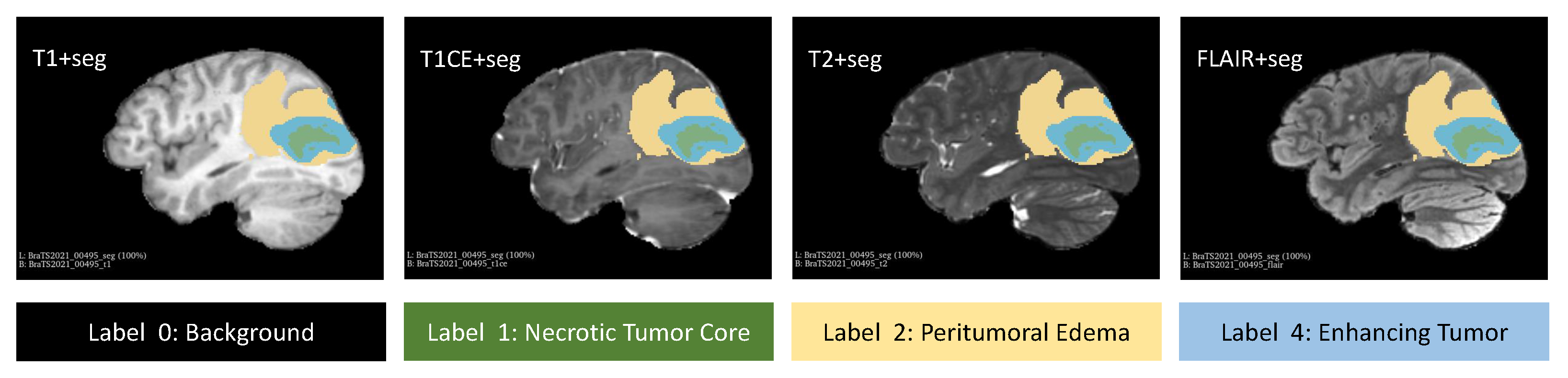Tomography 10 00116 g005