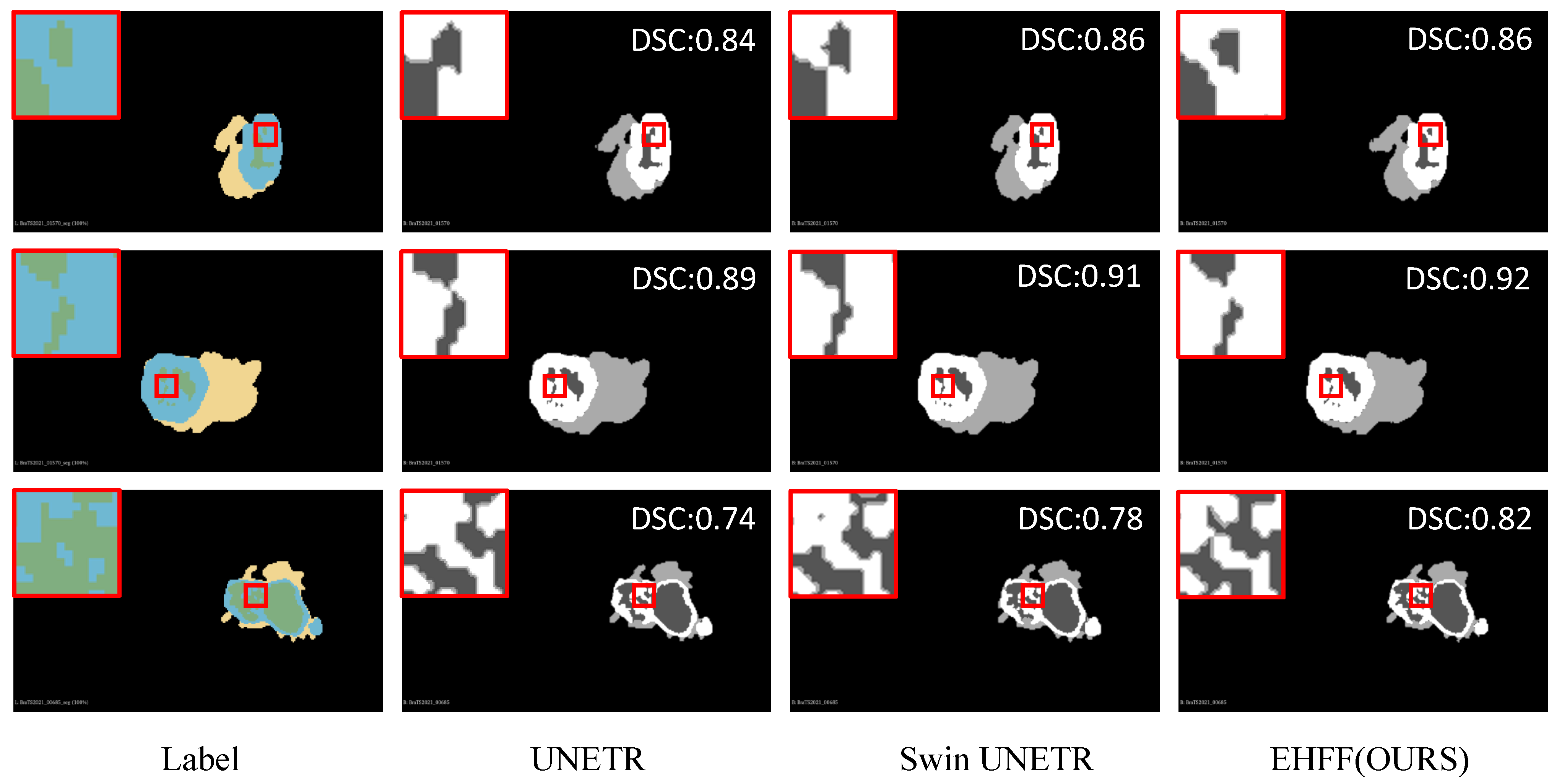 Tomography 10 00116 g006